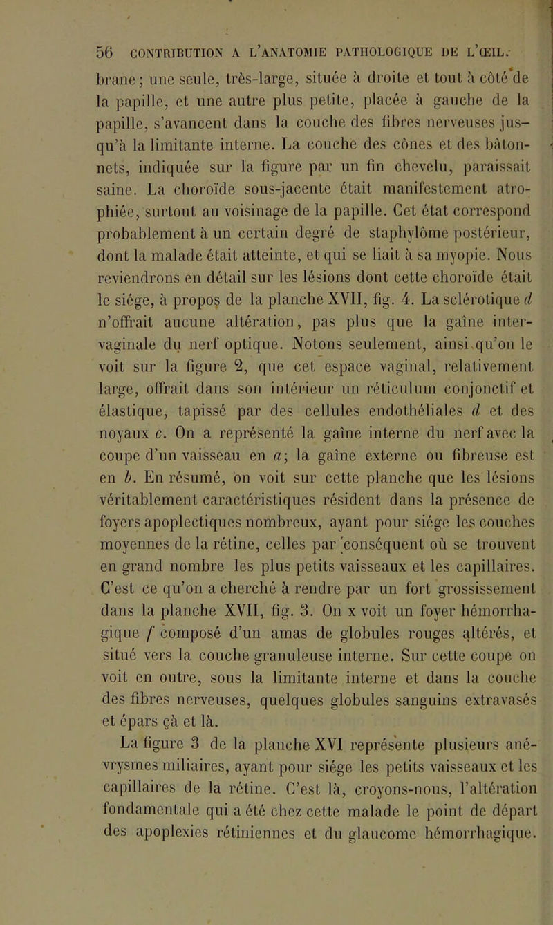 brane; une seule, très-large, située à droite et tout h côtcVle la papille, et une autre plus petite, placée à gauche de la papille, s’avancent dans la couche des fibres nerveuses jus- qu’à la limitante interne. La couche des cônes et des bâton- i nets, indiquée sur la figure par un fin chevelu, paraissait saine. La choroïde sous-jacente était manifestement atro- phiée, surtout au voisinage de la papille. Cet état correspond probablement à un certain degré de staphylôme postérieur, dont la malade était atteinte, et qui se liait à sa myopie. Nous reviendrons en détail sur les lésions dont cette choroïde était le siège, à propoç de la planche XVII, fig. 4. La sclérotique d n’offrait aucune altération, pas plus que la gaine inter- vaginale du nerf optique. Notons seulement, ainsi.qu’on le voit sur la figure 2, que cet espace vaginal, relativement large, offrait dans sou intérieur un réticulum conjonctif et élastique, tapissé par des cellules endothéliales d et des noyaux c. On a représenté la gaine interne du nerf avec la coupe d’un vaisseau en «; la gaine externe ou fibreuse est en b. En résumé, on voit sur cette planche que les lésions véritablement caractéristiques résident dans la présence de foyers apoplectiques nombreux, ayant pour siège les couches moyennes de la rétine, celles par 'conséquent où se trouvent en grand nombre les plus petits vaisseaux et les capillaires. C'est ce qu’on a cherché à rendre par un fort grossissement dans la planche XVII, fig. 3. On x voit un foyer hémorrha- gique f composé d’un amas de globules rouges altérés, et situé vers la couche granuleuse interne. Sur cette coupe on voit en outre, sous la limitante interne et dans la couche des fibres nerveuses, quelques globules sanguins extravasés et épars çà et là. La figure 3 de la planche XVI représente plusieurs ané- vrysmes miliaires, ayant pour siège les petits vaisseaux et les capillaires de la rétine. C’est là, croyons-nous, l’altération fondamentale qui a été chez cette malade le point de départ des apoplexies rétiniennes et du glaucome hémorrhagique.