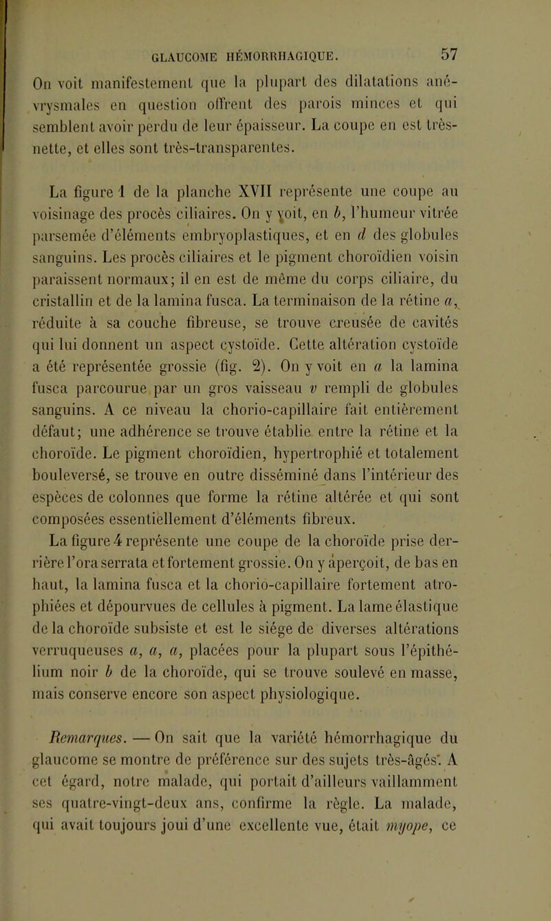 On voit manifestement que la plupart des dilatations ané- vrysmales en question offrent des parois minces et qui semblent avoir perdu de leur épaisseur. La coupe eu est très- nette, et elles sont très-transparentes. La figure 1 de la planche XYII représente une coupe au voisinage des procès ciliaires. On y yoit, en é, l’humeur vitrée parsemée d’éléments embryoplastiques, et en d des globules sanguins. Les procès ciliaires et le pigment choroïdien voisin paraissent normaux ; il en est de même du corps ciliaire, du cristallin et de la lamina fusca. La terminaison de la rétine a, réduite à sa couche fibreuse, se trouve creusée de cavités qui lui donnent un aspect cystoïde. Cette altération cystoïde a été représentée grossie (fig. 2). On y voit en a la lamina fusca parcourue par un gros vaisseau v rempli de globules sanguins. A ce niveau la chorio-capillaire fait entièrement défaut; une adhérence se trouve établie entre la rétine et la choroïde. Le pigment choroïdien, hypertrophié et totalement bouleversé, se trouve en outre disséminé dans l’intérieur des espèces de colonnes que forme la rétine altérée et qui sont composées essentiellement d’éléments fibreux. La figure 4 représente une coupe de la choroïde prise der- rière l’ora serrata et fortement grossie. On y aperçoit, de bas en haut, la lamina fusca et la chorio-capillaire fortement atro- phiées et dépourvues de cellules à pigment. La lame élastique de la choroïde subsiste et est le siège de diverses altérations vcrruqueuses a, a, a, placées pour la plupart sous l’épithé- lium noir b de la choroïde, qui se trouve soulevé en masse, mais conserve encore son aspect physiologique. Remarques. — On sait que la variété hémorrhagique du glaucome se montre de préférence sur des sujets très-âgés*. A cet égard, notre malade, qui portait d’ailleurs vaillamment ses quatre-vingt-deux ans, confirme la règle. La malade, qui avait toujours joui d’une excellente vue, ôtait myope, ce