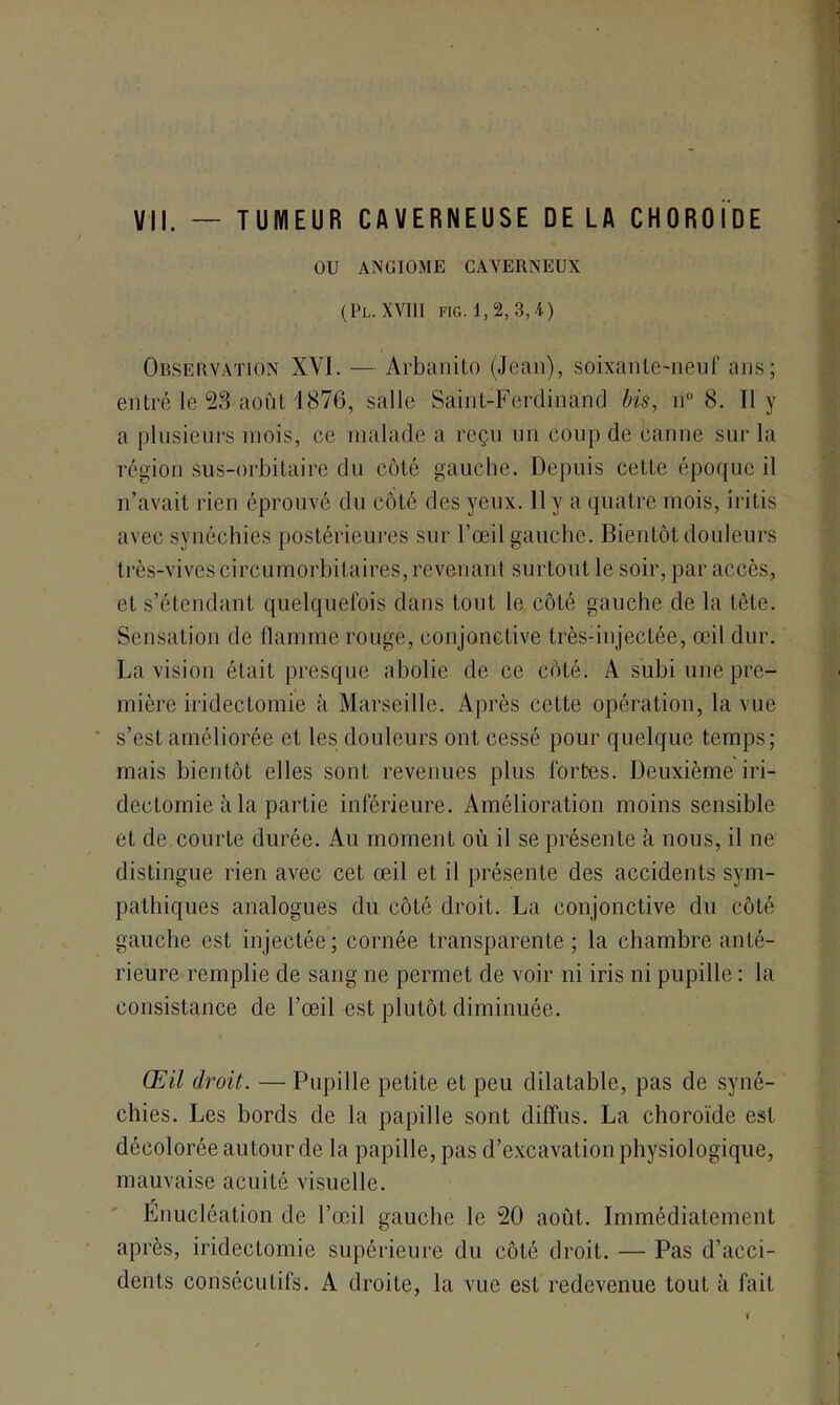 OU ANGIOME CAVERNEUX (PL. XVIII FIG. 1,2, 3,4) Observation XVI. — Arbanito (Jean), soixante-neuf ans; entré le 53 août 1876, salle Saint-Ferdinand bis, n° 8. Il y a plusieurs mois, ce malade a reçu un coup de canne sur la région sus-orbitaire du côté gauche. Depuis cette époque il n’avait rien éprouvé du côté des yeux. 11 y a quatre mois, iritis avec synéchies postérieures sur l’œil gauche. Bientôt douleurs très-vives circumorbilaires, revenant surtout le soir, par accès, et s’étendant quelquefois dans tout le côté gauche de la tête. Sensation de flamme rouge, conjonctive très-injectée, œil dur. La vision était presque abolie de ce côté. A subi une pre- mière iridectomie à Marseille. Après cette opération, la vue s’est améliorée et les douleurs ont cessé pour quelque temps; mais bientôt elles sont revenues plus fortes. Deuxième iri- dectomie à la partie inférieure. Amélioration moins sensible et de courte durée. Au moment où il se présente à nous, il ne distingue rien avec cet œil et il présente des accidents sym- pathiques analogues du côté droit. La conjonctive du côté gauche est injectée; cornée transparente; la chambre anté- rieure remplie de sang ne permet de voir ni iris ni pupille : la consistance de l’œil est plutôt diminuée. Œil droit. — Pupille petite et peu dilatable, pas de syné- chies. Les bords de la papille sont diffus. La choroïde est décolorée autour de la papille, pas d’excavation physiologique, mauvaise acuité visuelle. Énucléation de l’œil gauche le 20 août. Immédiatement après, iridectomie supérieure du côté droit. — Pas d’acci- dents consécutifs. A droite, la vue est redevenue tout à fait