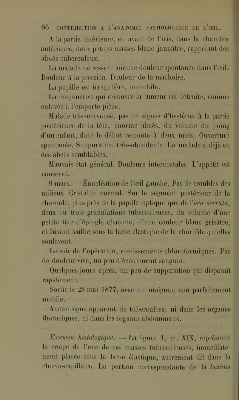 A la partie inférieure, en avant de l’iris, dans la chambre antérieure, deux petites masses blanc jaunâtre, rappelant des abcès tuberculeux. La malade ne ressent aucune douleur spontanée dans l’œil. Douleur à la pression. Douleur de la mâchoire. La pupille est irrégulière, immobile. La conjonctive qui recouvre la tumeur est détruite, comme enlevée à l’emporte-pièce. Malade très-nerveuse, pas de signes d’hystérie. À la partie postérieure de la tête, énorme abcès, du volume du poing d’un enfant, dont le début remonte à deux mois. Ouverture spontanée. Suppuration très-abondante. La malade a déjà eu des abcès semblables. Mauvais état général. Douleurs intercostales. L’appétit est conservé. 9 mars. — Énucléation de l’œil gauche. Pas de troubles des milieux. Cristallin normal. Sur le segment postérieur de la choroïde, plus près de la papille optique que de Y or a serrata, deux ou trois granulations tuberculeuses, du volume d’une petite tête d’épingle chacune, d’une couleur blanc grisâtre, et faisant saillie sous la lame élastique de la choroïde qu’elles soulèvent. Le soir de l’opération, vomissements chloroformiques. Pas de douleur vive, un peu d’écoulement sanguin. Quelques jours après, un peu de suppuration qui disparait rapidement. Sortie le 23 mai 1877, avec un moignon non parfaitement mobile. Aucun signe apparent de tuberculose, ni dans les organes thoraciques, ni dans les organes abdominaux. Examen histologique. — La figure 1, pl. XIX, représente la coupe de l’une de ces masses tuberculeuses, immédiate- ment placée sous la lame élastique, autrement dit dans la chorio-capillaire. La portion correspondante de la lamina