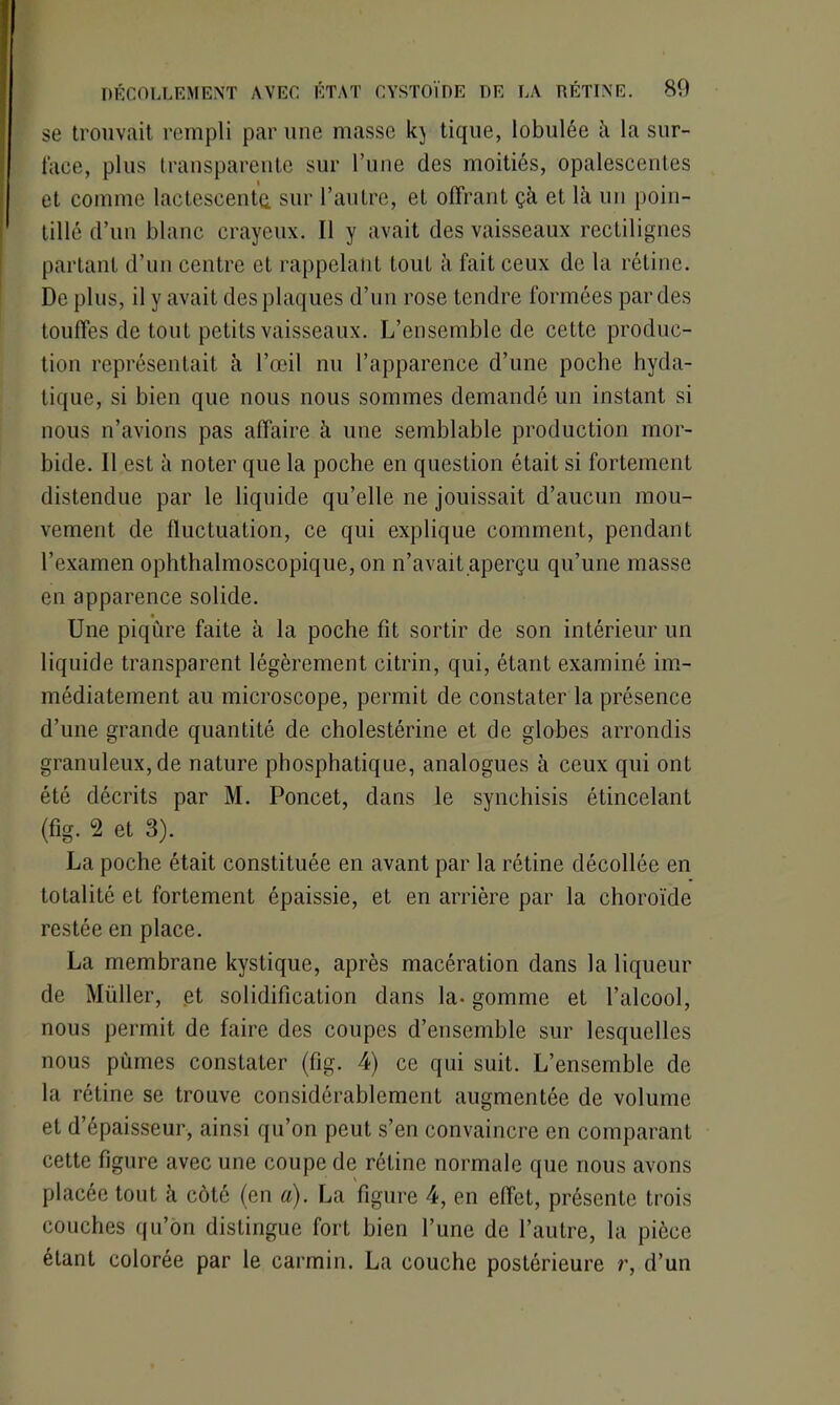 se trouvait rempli par une masse kj tique, lobulée à la sur- face, plus transparente sur l’une des moitiés, opalescentes et comme lactescente, sur l’autre, et offrant çà et là un poin- tillé d’un blanc crayeux. Il y avait des vaisseaux rectilignes partant d’un centre et rappelant tout à fait ceux de la rétine. De plus, il y avait des plaques d’un rose tendre formées par des touffes de tout petits vaisseaux. L’ensemble de cette produc- tion représentait à l’œil nu l’apparence d’une poche hyda- tique, si bien que nous nous sommes demandé un instant si nous n’avions pas affaire à une semblable production mor- bide. Il est à noter que la poche en question était si fortement distendue par le liquide qu’elle ne jouissait d’aucun mou- vement de fluctuation, ce qui explique comment, pendant l’examen ophthalmoscopique, on n’avait.aperçu qu’une masse en apparence solide. Une piqûre faite à la poche fit sortir de son intérieur un liquide transparent légèrement citrin, qui, étant examiné im- médiatement au microscope, permit de constater la présence d’une grande quantité de cholestérine et de globes arrondis granuleux, de nature phosphatique, analogues à ceux qui ont été décrits par M. Poncet, dans le synchisis étincelant (fig. 2 et 3). La poche était constituée en avant par la rétine décollée en totalité et fortement épaissie, et en arrière par la choroïde restée en place. La membrane kystique, après macération dans la liqueur de Müller, et solidification dans la- gomme et l’alcool, nous permit de faire des coupes d’ensemble sur lesquelles nous pûmes constater (fig. 4) ce qui suit. L’ensemble de la rétine se trouve considérablement augmentée de volume et d’épaisseur, ainsi qu’on peut s’en convaincre en comparant cette figure avec une coupe de rétine normale que nous avons placée tout à côté (en a). La figure 4, en effet, présente trois couches qu’on distingue fort bien l’une de l’autre, la pièce étant colorée par le carmin. La couche postérieure r, d’un