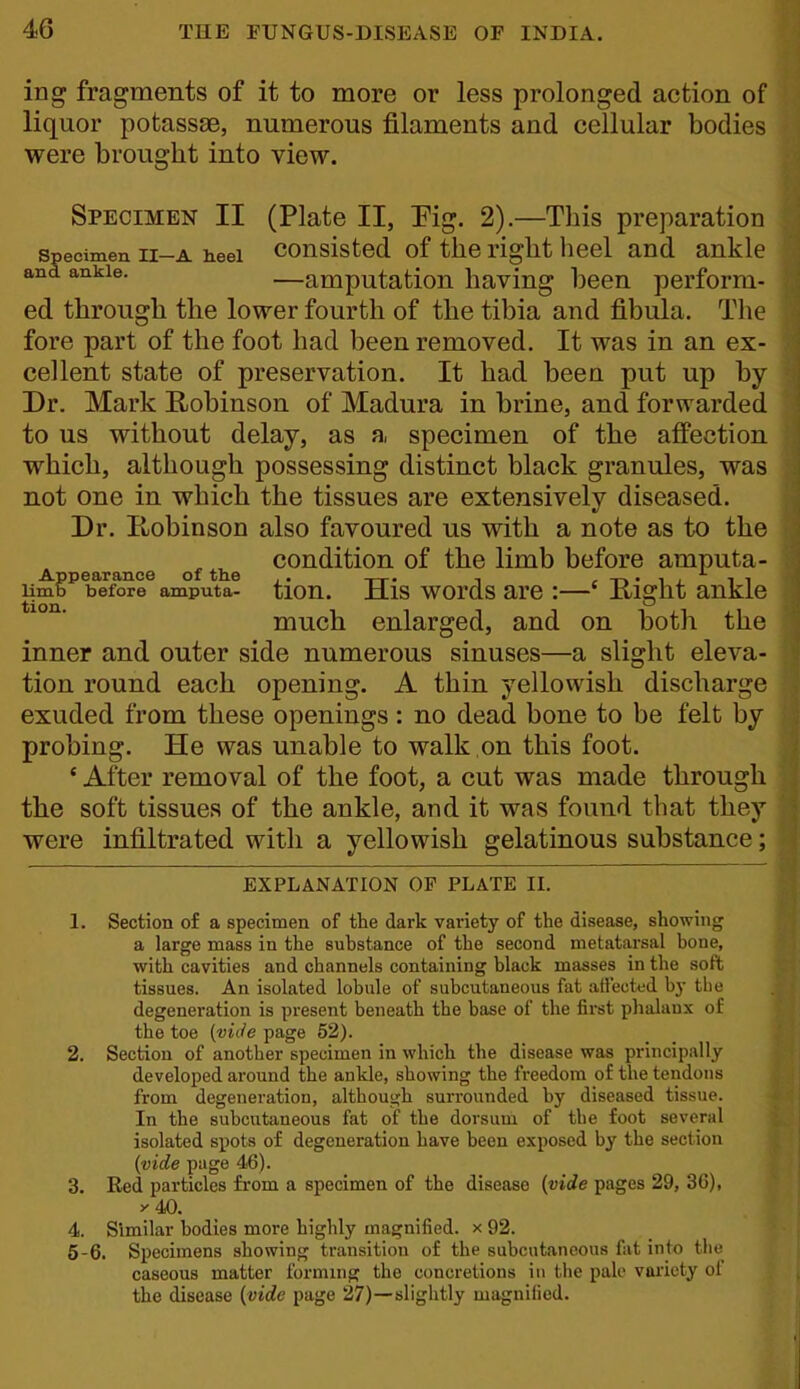 ing fragments of it to more or less prolonged action of liquor potassse, numerous filaments and cellular bodies were brought into view. Specimen ii-A heel consisted of the right lieel and ankle and ankle. -amputatiou having been perform- ^^,1 flip Inwpr Specimen II (Plate II, Eig. 2).—This preparation spe id ; ed through the lower fourth of the tibia and fibula. The fore part of the foot had been removed. It was in an ex- cellent state of preservation. It had been put up by Dr. Mark Robinson of Madura in brine, and forwarded to us without delay, as a specimen of the affection which, although possessing distinct black granules, was not one in which the tissues are extensively diseased. Dr. Ptobinson also favoured us with a note as to the condition of the limb before amputa- Appearance of tlie .. „. , , -r» • i j i i limb before amputa- tiou. His words are :—' iiight ankle much enlarged, and on both the inner and outer side numerous sinuses—a slight eleva- tion round each opening. A thin yellowish discharge exuded from these openings: no dead bone to be felt by probing. He was unable to walk on this foot. ' After removal of the foot, a cut was made through the soft tissues of the ankle, and it was found that they were infiltrated with a yellowish gelatinous substance; EXPLANATION OF PLATE II. 1. Section of a specimen of the dark variety of the disease, showing a large mass in the substance of the second metatarsal bone, with cavities and channels containing black masses in the soft tissues. An isolated lobule of subcutaneous fat allected by tlie degeneration is present beneath the base of the first phalanx of the toe (vic/e page 52). 2. Section of another specimen in which the disease was principally developed around the ankle, showing the freedom of the tendons from degeneration, althouijh surrounded by diseased tissue. In the subcutaneous fat of the dorsum of the foot several isolated spots of degeneration have been exposed by the section {vide page 46). 3. Red particles from a specimen of the disease {vide pages 29, 36), >- 40. 4. Similar bodies more highly magnified, x 92. 5-6. Specimens showing transition of the subcutaneous fat info the caseous matter forming the concretions in the pale variety oi the disease {vide page 27)—slightly magnified.