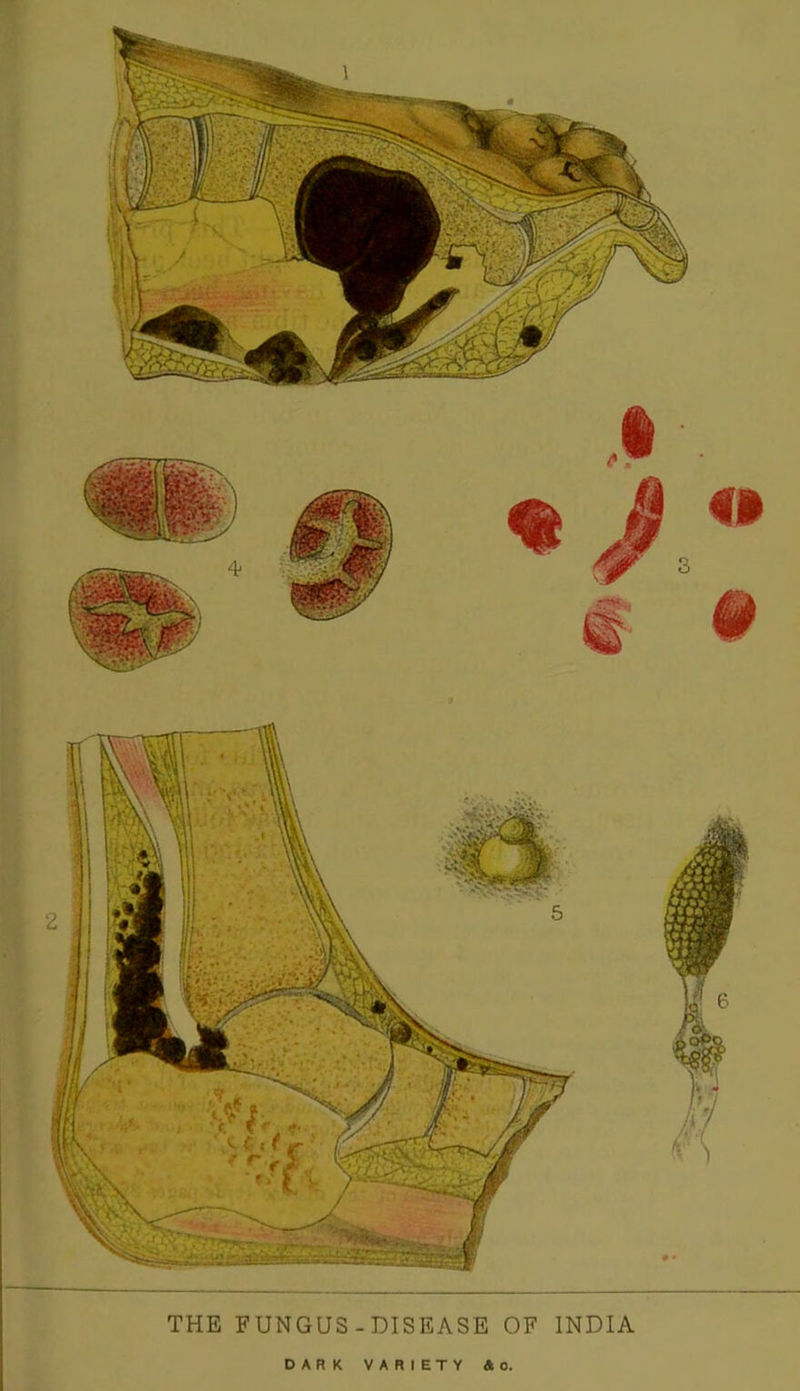 THE FUNGUS-DISEASE OF INDIA DARK VARIETY 4o.