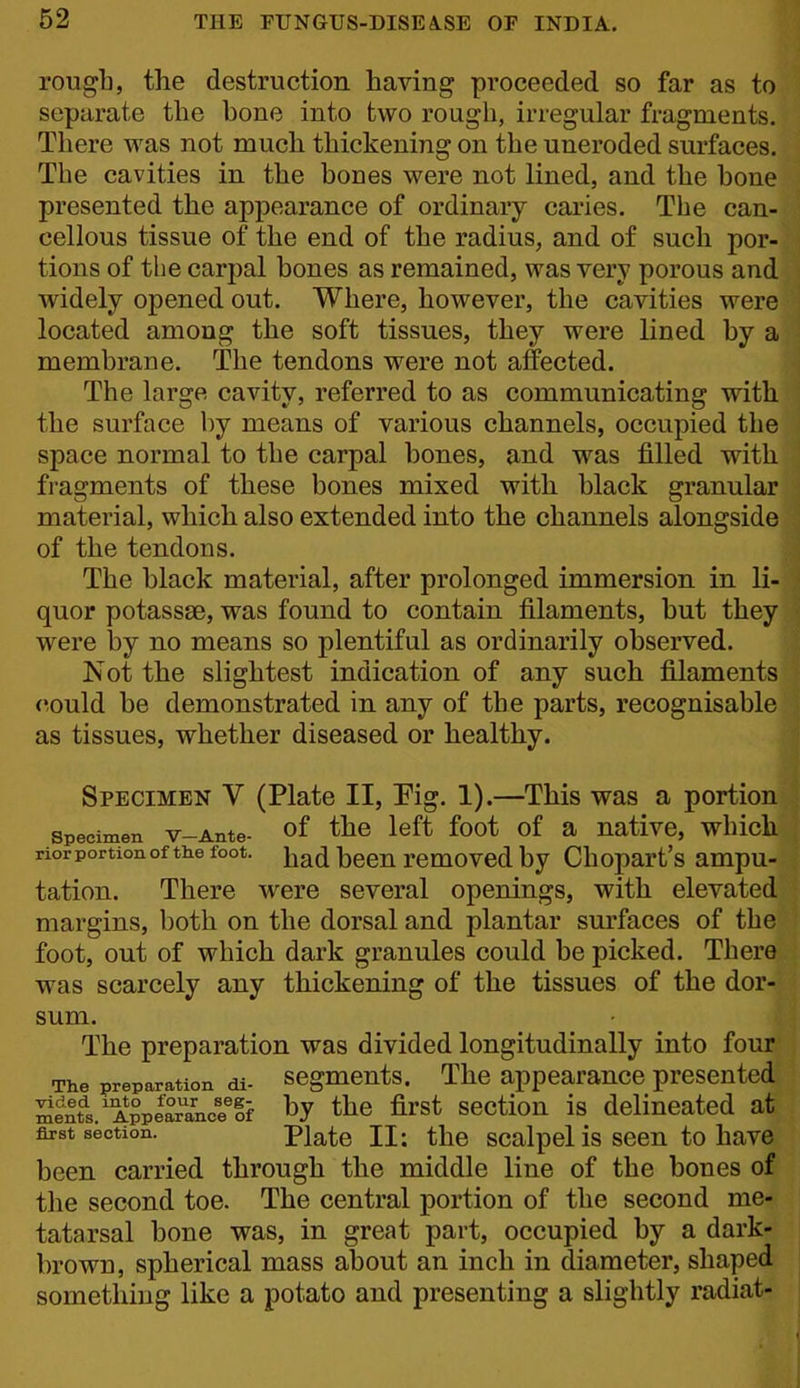 rough, the destruction having proceeded so far as to separate the bone into two rough, irregular fragments. There was not much thickening on the uneroded surfaces. The cavities in the bones were not lined, and the bone presented the appearance of ordinary caries. The can- cellous tissue of the end of the radius, and of such por- tions of the carpal bones as remained, was very porous and widely opened out. Where, however, the cavities were located among the soft tissues, they were lined by a membrane. The tendons were not affected. The large cavity, referred to as communicating with the surface by means of various channels, occupied the space normal to the carpal bones, and was filled with fragments of these bones mixed with black granular material, which also extended into the channels alongside of the tendons. The black material, after prolonged immersion in li quor potassse, was found to contain filaments, but the were by no means so plentiful as ordinarily observed. Not the slightest indication of any such filaments could be demonstrated in any of the parts, recognisable as tissues, whether diseased or healthy. Specimen V (Plate II, Eig. 1).—This was a portion Specimen V-Ante- of thc left foot of a UativC, whicll rior portion of the foot, jj^^j ^qq^^ rcmovcd by Chopart's ampu- tation. There were several openings, with elevated margins, both on the dorsal and plantar surfaces of the foot, out of which dark granules could be picked. There was scarcely any thickening of the tissues of the dor- sum. The preparation was divided longitudinally into four The preparation di- segmcuts. Thc appcaraucc presented Sent^sA^ppear'ance'lf ^y the first scctiou is delineated at first section. Plate II: the scalpel is seen to have been carried through the middle line of the bones of the second toe. The central portion of the second me- tatarsal bone was, in great part, occupied by a dark- brown, spherical mass about an inch in diameter, shaped something like a potato and presenting a slightly radiat-