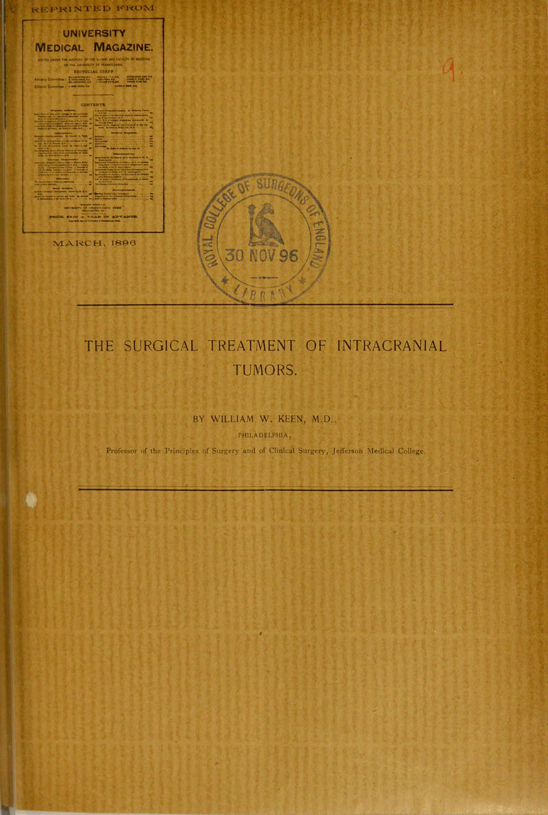 university Medical Magazine. 0# THi uH'iftMir* o< »«MniM^' THE SURGICAL TREATMENT OF INTRACRANIAL TUMORS. BY WILLIAM W. KEEN, M.D., PHILADELPHIA, Professor r>f the Principles of Surgerj' and of Clinical Surgery, Jefferson Medical College.