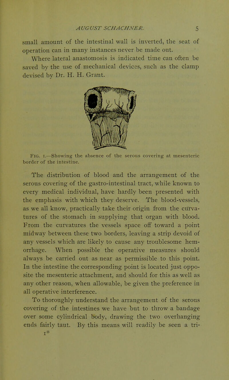 small amount of the intestinal wall is inverted, the seat of operation can in many instances never be made out. Where lateral anastomosis is indicated time can often be saved by the use of mechanical devices, such as the clamp devised by Dr. H. H. Grant. Fig. i.—Showing the absence of the serous covering at mesenteric border of the intestine. The distribution of blood and the arrangement of the serous covering of the gastro-intestinal tract, while known to every medical individual, have hardly been presented with the emphasis with which they deserve. The blood-vessels, as we all know, practically take their origin from the curva- tures of the stomach in supplying that organ with blood. From the curvatures the vessels space off toward a point midway between these two borders, leaving a strip devoid of any vessels which are likely to cause any troublesome hem- orrhage. When possible the operative measures should always be carried out as near as permissible to this point. In the intestine the corresponding point is located just oppo- site the mesenteric attachment, and should for this as well as any other reason, when allowable, be given the preference in all operative interference. To thoroughly understand the arrangement of the serous covering of the intestines we have but to throw a bandage over some cylindrical body, drawing the two overhanging ends fairly taut. By this means will readily be seen a tri- i*