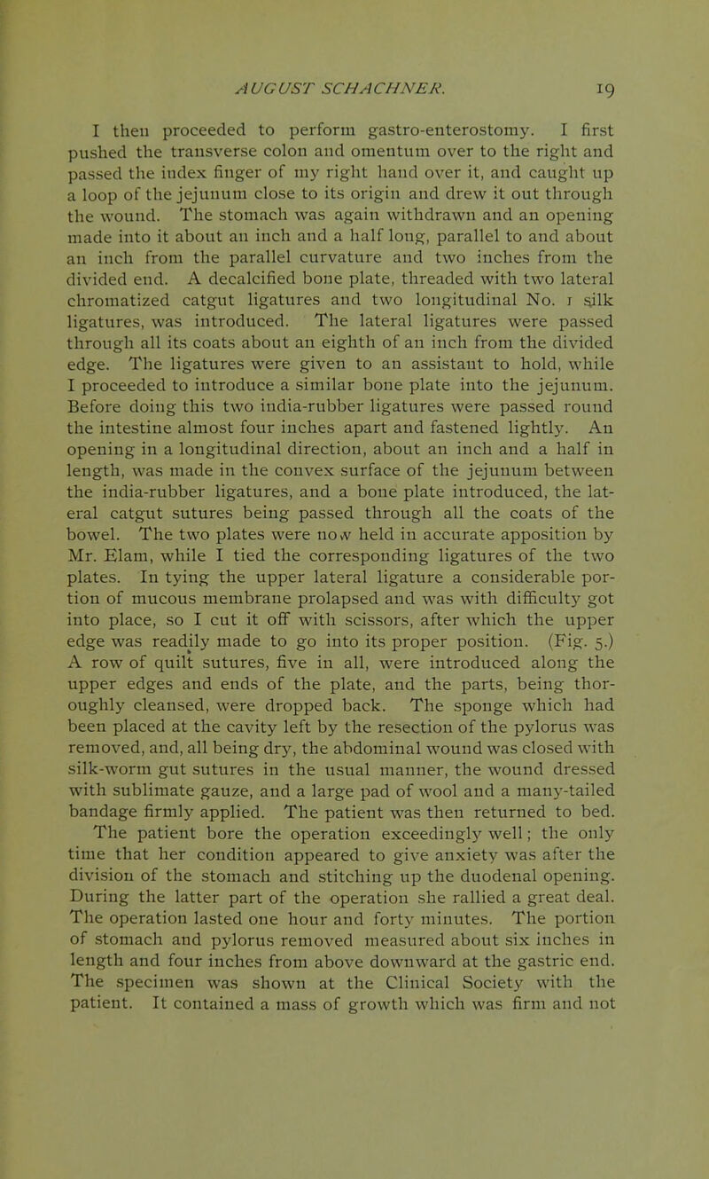 I then proceeded to perform gastroenterostomy. I first pushed the transverse colon and omentum over to the right and passed the index finger of my right hand over it, and caught up a loop of the jejunum close to its origin and drew it out through the wound. The stomach was again withdrawn and an opening made into it about an inch and a half loug, parallel to and about an inch from the parallel curvature and two inches from the divided end. A decalcified bone plate, threaded with two lateral chromatized catgut ligatures and two longitudinal No. 1 sjlk ligatures, was introduced. The lateral ligatures were passed through all its coats about an eighth of an inch from the divided edge. The ligatures were given to an assistant to hold, while I proceeded to introduce a similar bone plate into the jejunum. Before doing this two india-rubber ligatures were passed round the intestine almost four inches apart and fastened lightly. An opening in a longitudinal direction, about an inch and a half in length, was made in the convex surface of the jejunum between the india-rubber ligatures, and a bone plate introduced, the lat- eral catgut sutures being passed through all the coats of the bowel. The two plates were novv held in accurate apposition by Mr. Elam, while I tied the corresponding ligatures of the two plates. In tying the upper lateral ligature a considerable por- tion of mucous membrane prolapsed and was with difficulty got into place, so I cut it off with scissors, after which the upper edge was readily made to go into its proper position. (Fig. 5.) A row of quilt sutures, five in all, were introduced along the upper edges and ends of the plate, and the parts, being thor- oughly cleansed, were dropped back. The sponge which had been placed at the cavity left by the resection of the pylorus was removed, and, all being dry, the abdominal wound was closed with silk-worm gut sutures in the usual manner, the wound dressed with sublimate gauze, and a large pad of wool and a many-tailed bandage firmly applied. The patient was then returned to bed. The patient bore the operation exceedingly well; the only time that her condition appeared to give anxiety was after the division of the stomach and stitching up the duodenal opening. During the latter part of the operation she rallied a great deal. The operation lasted one hour and forty minutes. The portion of stomach and pylorus removed measured about six inches in length and four inches from above downward at the gastric end. The specimen was shown at the Clinical Society with the patient. It contained a mass of growth which was firm and not