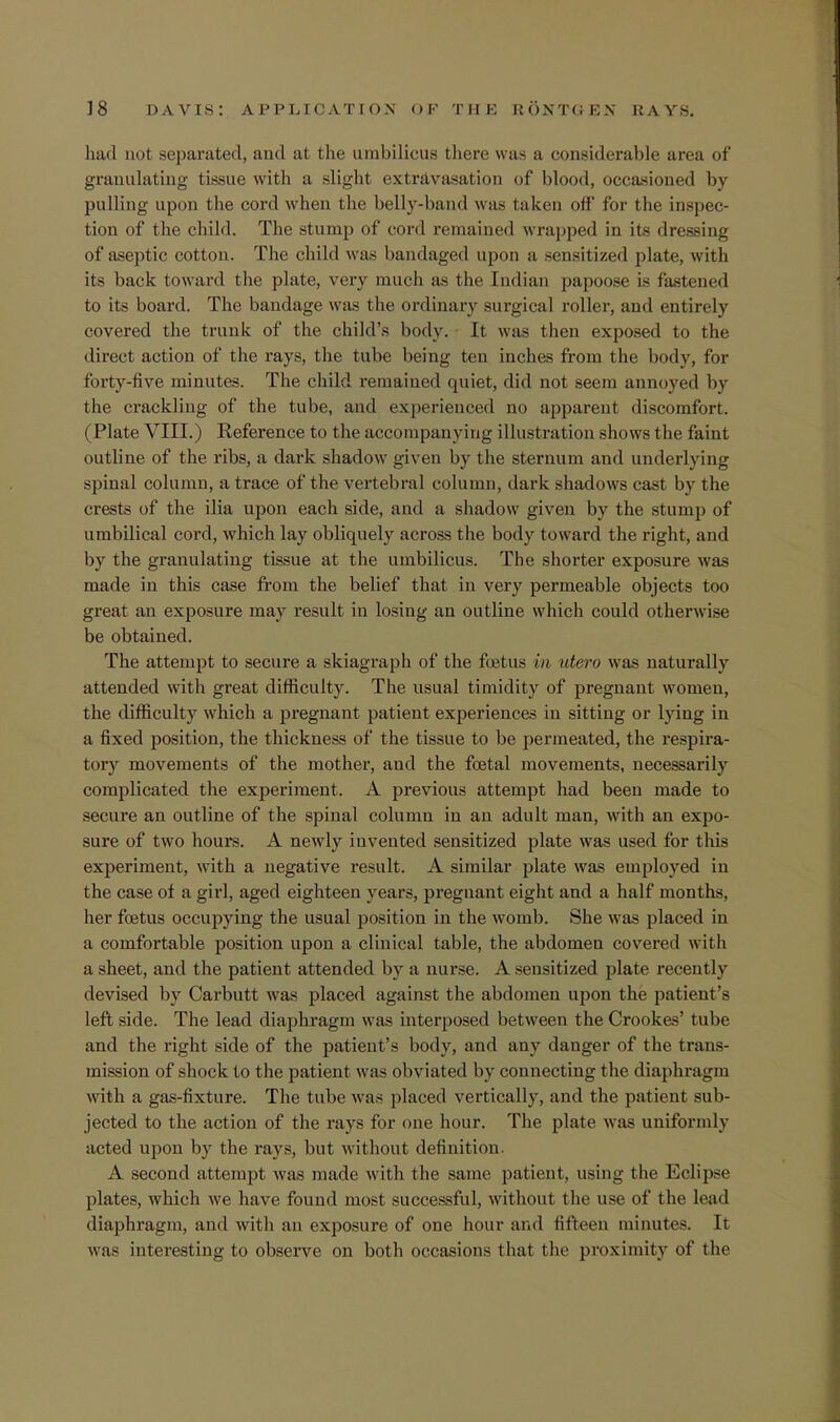 had not separated, and at the umbilicus there was a considerable area of granulating tissue with a slight extravasation of blood, occasioned by pulling upon the cord when the belly-band was taken off' for the inspec- tion of the child. The stump of cord remained wrapped in its dressing of aseptic cotton. The child was bandaged upon a sensitized plate, with its back toward tlie plate, very much as the Indian papoose is fastened to its board. The bandage was the ordinary surgical roller, and entirely covered the trunk of the child's body. It was then exposed to the direct action of the rays, the tube being ten inches from the body, for forty-five minutes. The child remained quiet, did not seem annoyed by the crackling of the tube, and experienced no apparent discomfort. (Plate VIII.) Reference to the accompanying illustration shows the faint outline of the ribs, a dark shadow given by the sternum and underlying spinal column, a trace of the vertebral column, dark shadows cast by the crests of the ilia upon each side, and a shadow given by the stump of umbilical cord, which lay obliquely across the body toward the right, and by the granulating tissue at the umbilicus. The shorter exposure was made in this case from the belief that in very permeable objects too great an exposure may result in losing an outline which could otherwise be obtained. The attempt to secure a skiagraph of the foetus in utero was naturally attended with great difficulty. The usual timidity of pregnant women, the difficulty which a pregnant patient experiences in sitting or lying in a fixed position, the thickness of the tissue to be permeated, the respira- tory movements of the mother, and the foetal movements, necessarily complicated the experiment. A previous attempt had been made to secure an outline of the spinal column in an adult man, with an expo- sure of two hours. A newly invented sensitized plate was used for this experiment, with a negative result. A similar plate was employed in the case of a girl, aged eighteen years, pregnant eight and a half months, her foetus occupying the usual position in the womb. She was placed in a comfortable position upon a clinical table, the abdomen covered with a sheet, and the patient attended by a nurse. A sensitized plate recent 1 v devised by Carbutt was placed against the abdomen upon the patient's left side. The lead diaphragm was interposed between the Crookes' tube and the right side of the patient's body, and any danger of the trans- mission of shock to the patient was obviated by connecting the diaphragm with a gas-fixture. The tube was placed vertically, and the patient sub- jected to the action of the rays for one hour. The plate was uniformly acted upon by the rays, but without definition. A second attempt was made with the same patient, using the Eclipse plates, which we have found most successful, without the use of the lead diaphragm, and with an exposure of one hour ami fifteen minutes. It was interesting to observe on both occasions that the proximity of the