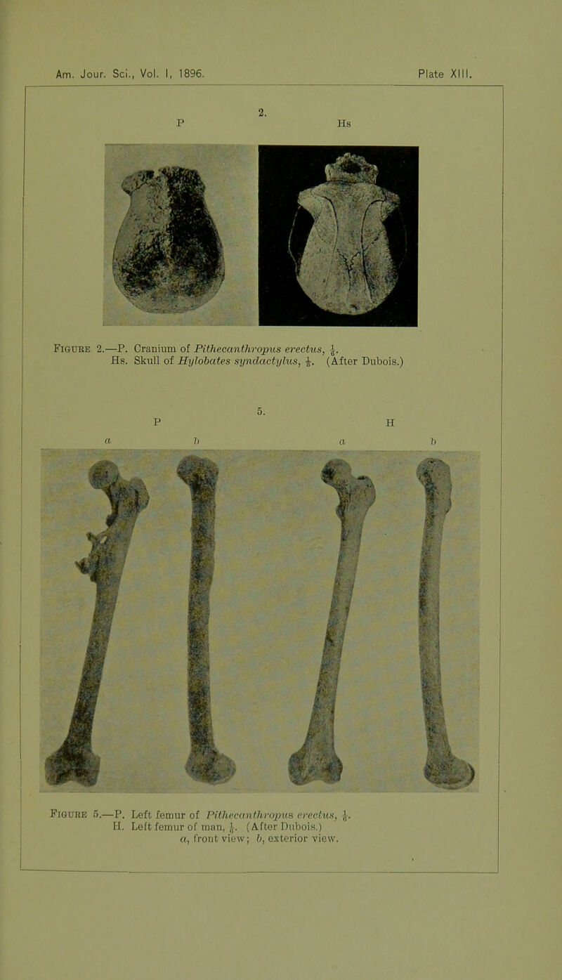 Figure 5.—P. Left femur of PithecanthropuB erectus, f. H. Left femur of man, J. (After Dubois.) a, front view; h, exterior view.