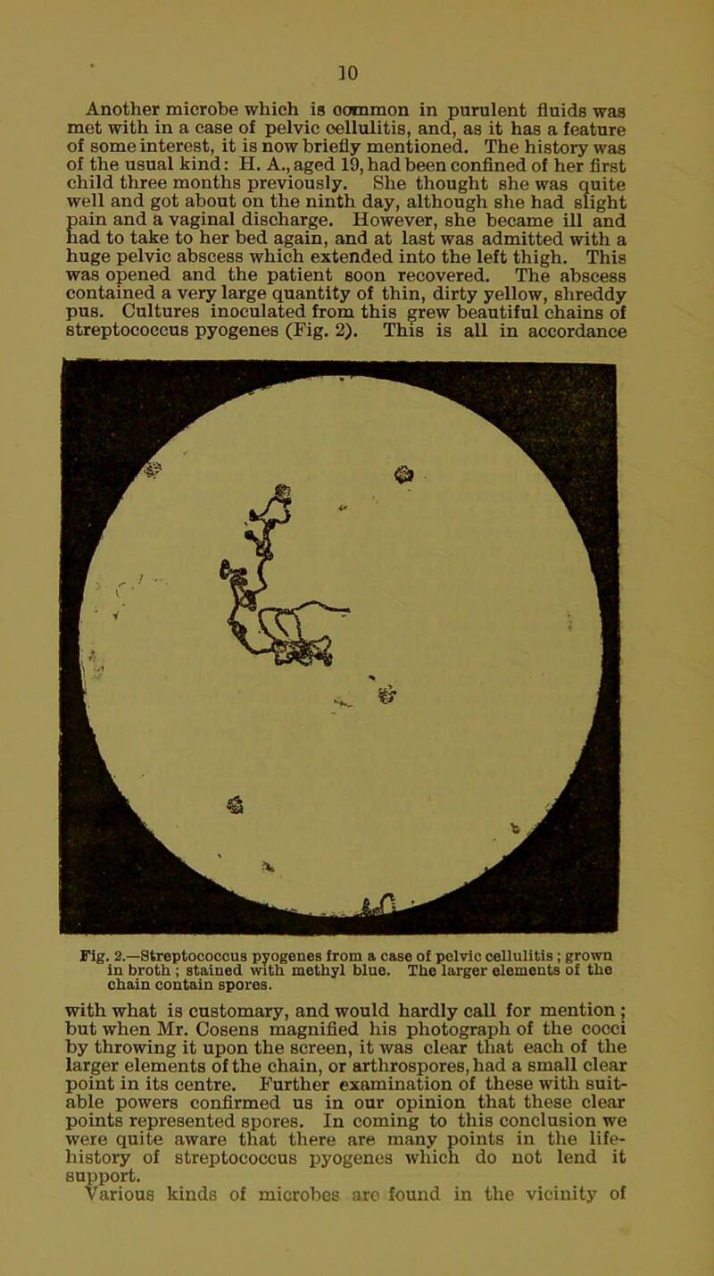 Another microbe which is oommon in purulent fluids was met with in a case of pelvic cellulitis, and, as it has a feature of some interest, it is now briefly mentioned. The history was of the usual kind: H. A., aged 19, had been confined of her first child three months previously. She thought she was quite well and got about on the ninth day, although she had slight pain and a vaginal discharge. However, she became ill and had to take to her bed again, and at last was admitted with a huge pelvic abscess which extended into the left thigh. This was opened and the patient soon recovered. The abscess contained a very large quantity of thin, dirty yellow, shreddy pus. Cultures inoculated from this grew beautiful chains of streptococcus pyogenes (Fig. 2). This is all in accordance Fig. 2.—Streptococcus pyogenes from a case of pelvic cellulitis; grown in broth; stained with methyl blue. The larger elements of the chain contain spores. with what is customary, and would hardly call for mention ; but when Mr. Cosens magnified his photograph of the cocci by throwing it upon the screen, it was clear that each of the larger elements of the chain, or arthrospores, had a small clear point in its centre. Further examination of these with suit- able powers confirmed us in our opinion that these clear points represented spores. In coming to this conclusion we were quite aware that there are many points in the life- history of streptococcus pyogenes which do not lend it support. Various kinds of microbes aro found in the vicinity of