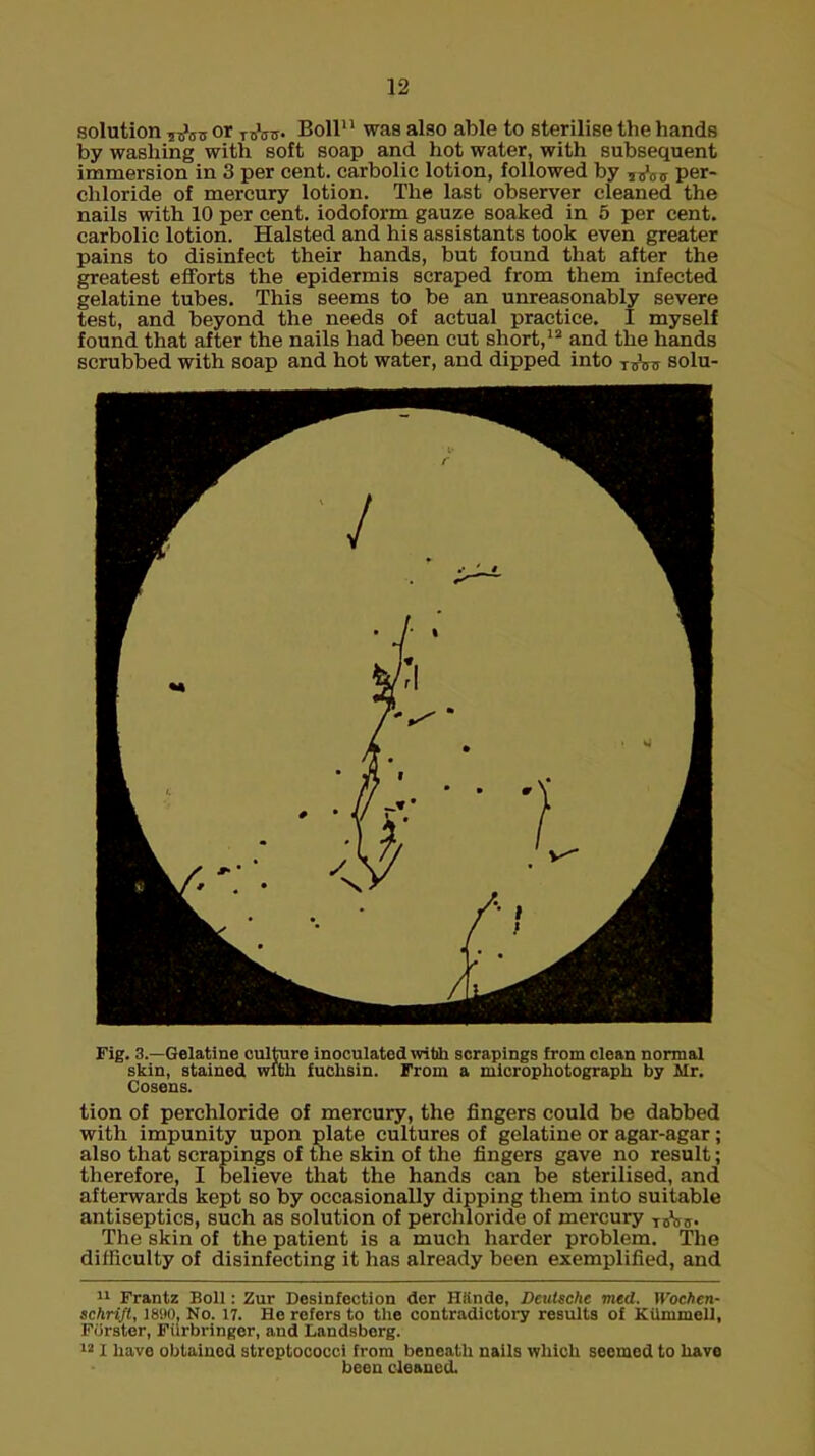 solution 15>s,s or TBW Boll11 was also able to sterilise the hands by washing with soft soap and hot water, with subsequent immersion in 3 per cent, carbolic lotion, followed by ?J0v per- chloride of mercury lotion. The last observer cleaned the nails with 10 per cent, iodoform gauze soaked in 5 per cent, carbolic lotion. Halsted and his assistants took even greater pains to disinfect their hands, but found that after the greatest efforts the epidermis scraped from them infected gelatine tubes. This seems to be an unreasonably severe test, and beyond the needs of actual practice. I myself found that after the nails had been cut short,12 and the hands scrubbed with soap and hot water, and dipped into T1feir solu- Fig. 3.—Gelatine culture inoculated with scrapings from clean normal skin, stained with fuchsin. From a niicrophotograph by Mr. Cosens. tion of perchloride of mercury, the fingers could be dabbed with impunity upon plate cultures of gelatine or agar-agar; also that scrapings of the skin of the fingers gave no result; therefore, I believe that the hands can be sterilised, and afterwards kept so by occasionally dipping them into suitable antiseptics, such as solution of perchloride of mercury I5\i5. The skin of the patient is a much harder problem. The difficulty of disinfecting it has already been exemplified, and 11 Frantz Boll: Zur Desinfection der Httnde, Deutsche med. Wochen- schrift, 18!>0. No. 17. He refers to the contradictory results of KUmmell, Filrster, Fiirbringer, and Landsborg. 121 have obtained streptococci from beneath nails which seemed to have been cleaned.