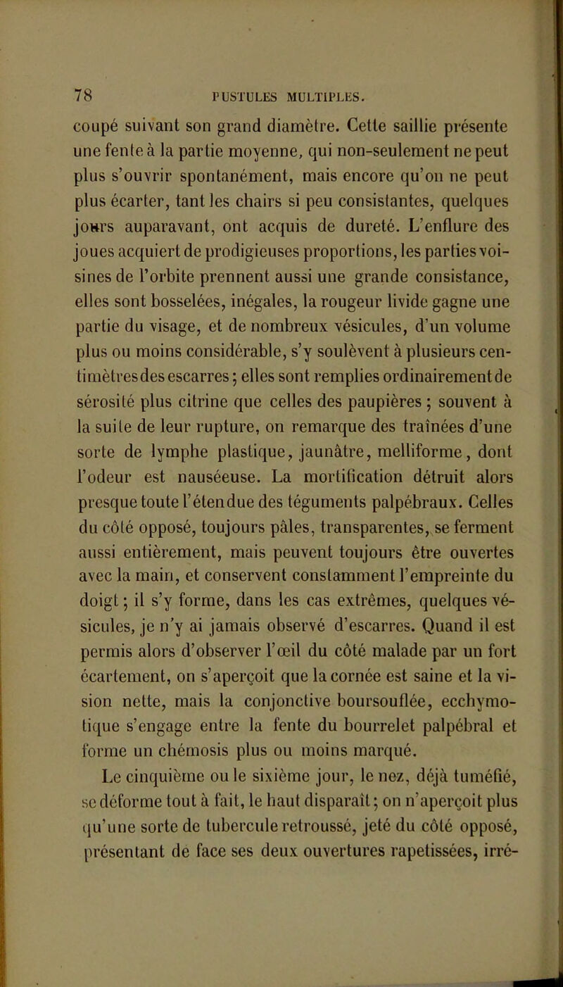 coupé suivant son grand diamètre. Cette saillie présente une fente à la partie moyenne, qui non-seulement ne peut plus s'ouvrir spontanément, mais encore qu'on ne peut plus écarter, tant les chairs si peu consistantes, quelques jonrs auparavant, ont acquis de dureté. L'enflure des joues acquiert de prodigieuses proportions, les parties voi- sines de l'orbite prennent aussi une grande consistance, elles sont bosselées, inégales, la rougeur livide gagne une partie du visage, et de nombreux vésicules, d'un volume plus ou moins considérable, s'y soulèvent à plusieurs cen- timètres des escarres ; elles sont remplies ordinairement de sérosité plus citrine que celles des paupières ; souvent à la suite de leur rupture, on remarque des traînées d'une sorte de lymphe plastique, jaunâtre, melliforme, dont l'odeur est nauséeuse. La mortification détruit alors presque toute l'étendue des téguments palpébraux. Celles du côté opposé, toujours pâles, transparentes, se ferment aussi entièrement, mais peuvent toujours être ouvertes avec la main, et conservent constamment l'empreinte du doigt \ il s'y forme, dans les cas extrêmes, quelques vé- sicules, je n'y ai jamais observé d'escarres. Quand il est permis alors d'observer l'œil du côté malade par un fort écartement, on s'aperçoit que la cornée est saine et la vi- sion nette, mais la conjonctive boursouflée, ecchymo- tique s'engage entre la fente du bourrelet palpébral et forme un chémosis plus ou moins marqué. Le cinquième ou le sixième jour, le nez, déjà tuméfié, se déforme tout à fait, le haut disparaît ; on n'aperçoit plus qu'une sorte de tubercule retroussé, jeté du côté opposé, présentant de face ses deux ouvertures rapetissées, irré-