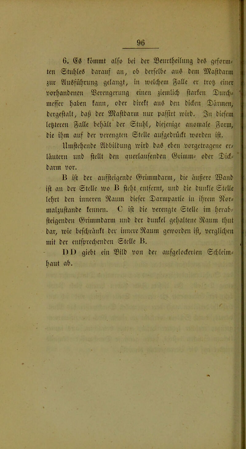 6, ?ommt atfo bet ber 23ciirtf;eifuug beS geformt teil ®tiil)te3 barauf an, ob berfelbe miö bem 9)iaftbavni jiiv §lii6fül)riiiig gelangt, in nielc^eni gaüe er tro^ einer oor^atibenen S3erengcriing einen 3ienilidb ftarfen 2)iirc^# mcffer !^aben fann, ober bireft aii6 ben bicfen 2)ärmen, bergeftalt, bap ber SiJiaftbarni nur ).'‘affirt luirb. 3n biefem le^teren S^ll« bel)a(t' ber ®tul;t, biejenige anomale Sonn, bic if)itt auf ber verengten ©teile aufgebrücft toorben ift. Umftel)enbe Slbbilbung mirb ba6 eben oorgetragene er# läutern unb ftellt ben querlaufenben ©rimiii# ober 3)icf# bann oor. B ift ber aufftcigcnbc ©rimmbann, bie äußere 2Banb ift an ber ©teile U)o B ftel;t entfernt, unb bie btinfle ©teile leiert ben inneren D^auln biefer 3)arniV'artie in if;rein 9Zor# maliuftanbe fcntieti. C ift bie oerengte ©teile iin l;erab# fteigenben ©rimmbann unb ber bunfet gefialtene 9iauni tljut bar, mie befcbränft ber innere Dkuin geioorben ift, oerglicfien mit ber entfpredjcnben ©teile B. DD giebt ein S3ilb oon ber aufgeloderten ©cljleim# l;aut ab.