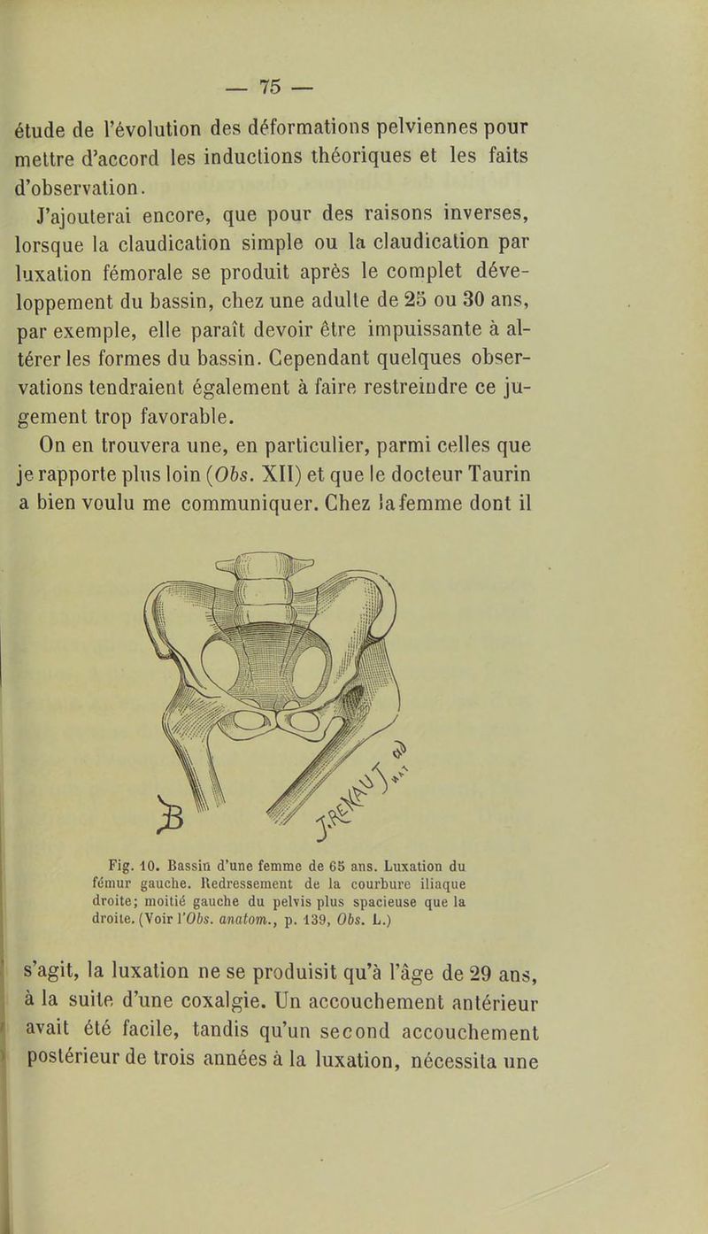 étude de l'évolution des déformations pelviennes pour mettre d'accord les inductions théoriques et les faits d'observation. J'ajouterai encore, que pour des raisons inverses, lorsque la claudication simple ou la claudication par luxation fémorale se produit après le complet déve- loppement du bassin, chez une adulte de 25 ou 30 ans, par exemple, elle paraît devoir être impuissante à al- térer les formes du bassin. Cependant quelques obser- vations tendraient également à faire restreindre ce ju- gement trop favorable. On en trouvera une, en particulier, parmi celles que je rapporte plus loin (06s. XII) et que le docteur Taurin a bien voulu me communiquer. Chez la femme dont il s'agit, la luxation ne se produisit qu'à l'âge de 29 ans, à la suite d'une coxalgie. Un accouchement antérieur avait été facile, tandis qu'un second accouchement postérieur de trois années à la luxation, nécessita une Fig. 10. Bassin d'une femme de 65 ans. Luxation du fémur gauche. Redressement de la courbure iliaque droite; moitié gauche du pelvis plus spacieuse que la droite. (Voir l'Obs. anatom., p. 139, 06s. L.)