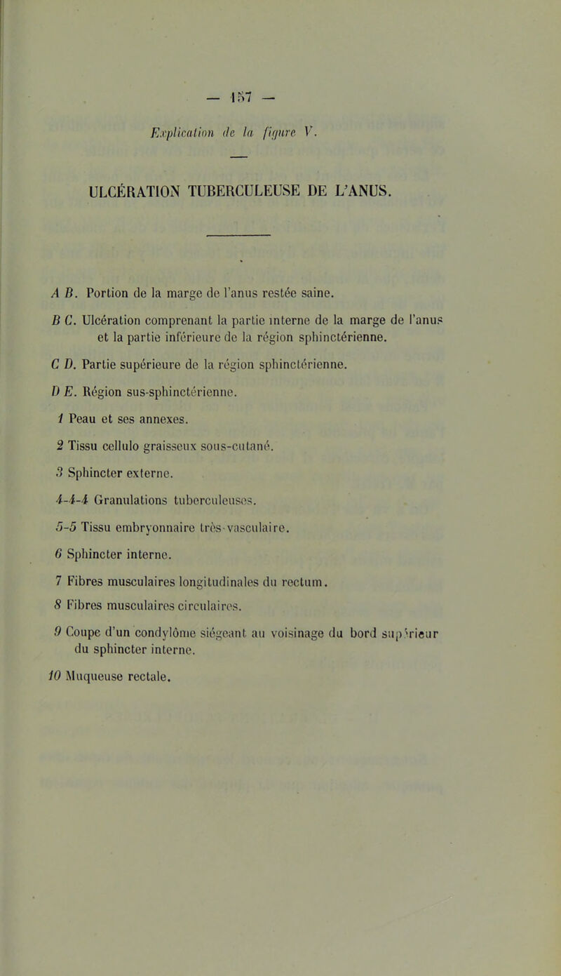 ULCÉRATlOiN TUBERCULEUSE DE L'ANUS. A B. Portion de la marge de l'anus restée saine. B C. Ulcération comprenant la partie mterne de la marge de l'anus et la partie inférieure de la région spliinctérienne. C D. Partie supérieure de la région spliinctérienne. D E. Région sus-sphinctérienne. 1 Peau et ses annexes. 2 Tissu cellulo graisseux sous-cutané. 5 Sphincter externe. 4- i-4 Granulations tuberculeuse-?. 5- 5 Tissu embryonnaire très-vasculaire. 6 Sphincter interne. 7 Fibres musculaires longitudinales du rectum. 8 Fibres musculaires circulaires. 9 Coupe d'un condylôme siégeant au voisinage du bord sup érieur du sphincter interne. 10 Muqueuse rectale.