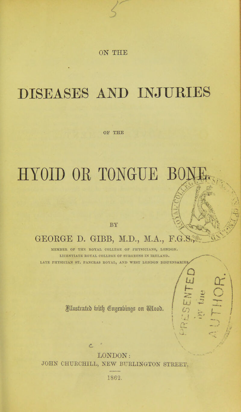 DISEASES AND INJURIES OF THE HYOID OR TONGUE BOm. BY / \ GEOUGE D. GIBB, M.D., M,A., F.G.'S^^-,:^^ MEMBER OP THE ROYAL COLLEQE OP PHYSICIANS, LONDON. LICENTIATE ROY'AL COLLEGE OF SVUGEONS IN IRELAND. LATE PHYSICIAN ST. PANCRAS ROYAL, AND WEST LONDON DISPENSAKIES, LONDON: JOHN CHURCHILL, NEW BURLINGTON STREET. 1862.