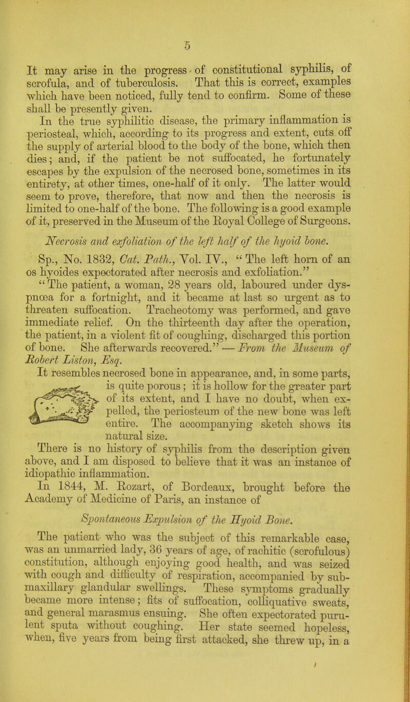 It may arise in the progress - of constitutional syphilis, of scrofula, and of tuberculosis. That this is correct, examples which have been noticed, fully tend to conjB.rm. Some of these shall be presently given. In the true syphilitic disease, the primary inflammation is periosteal, which, according to its progress and extent, cuts off the supply of arterial blood to the body of the bone, which then dies; and, if the patient be not suffocated, he fortunately escapes by the expulsion of the necrosed bone, sometimes in its entirety, at other times, one-half of it only. The latter would seem to prove, therefore, that now and then the necrosis is limited to one-half of the bone. The following is a good example of it, preserved in the Museum of the Royal College of Surgeons. Necrosis and exfoliation of the left half of the hyoid hone. Sp., No. 1832, Cat. Path., Yol. IV.,  The left horn of an OS hyoides expectorated after necrosis and exfoliation.  The patient, a woman, 28 years old, laboured under dys- pnoea for a fortnight, and it became at last so m-gent as to threaten suffocation. Tracheotomy was performed, and gave immediate relief. On the thirteenth day after the operation, the patient, in a violent fit of coughing, discharged this portion of bone. She afterwards recovered. — From the Museum of Robert Liston, Esq. It resembles necrosed bone in appearance, and, in some parts, is quite porous ; it is hollow for the gi'eater part of its extent, and I have no doubt, when ex- pelled, the periosteum of the new bone was left entire. The accompanying sketch shows its natural size. There is no history of syphilis from the description given above, and I am disposed to believe that it was an instance of idiopathic inflammation. In 1844, M. Rozart, of Bordeaux, brought before the Academy of Medicine of Paris, an instance of Spontaneous Expulsion of the Syoid Bone. The patient who was the subject of this remarkable case, was an unmarried lady, 36 years of age, of rachitic (scrofalous) constitution, although enjoying good health, and was seized with cough and difficulty of respiration, accompanied by sub- maxillary glandular swellings. These s^onptoms gradually became more intense; fits of suffocation, colliquative sweats, and general marasmus ensuing. She often expectorated puru- lent sputa without coughing. Her state seemed hopeless, when, five years fi'om being first attacked, she thi-ew up, in a