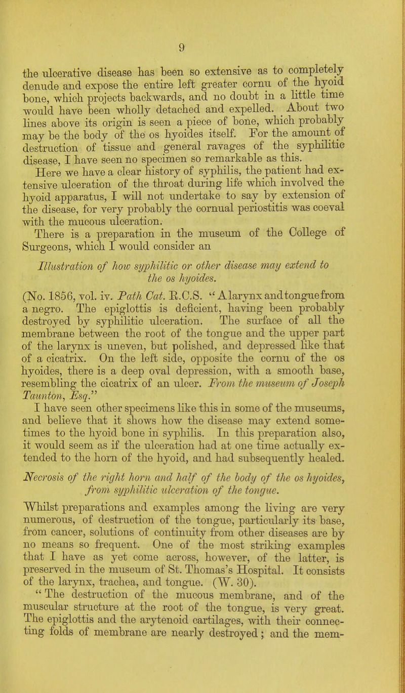 tlie ulcerative disease lias been so extensive as to completely denude and expose the entire left greater cornu of the hyoid bone, which projects backwards, and no doubt in a little time would have been wholly detached and expelled. ^ About two lines above its origin is seen a piece of bone, which probably may be the body of the os hyoides itself. For the amount of destruction of tissue and general ravages of the _ syphilitic disease, I have seen no specimen so remarkable as this. Here we have a clear history of syphilis, the patient had ex- tensive ulceration of the throat during life which involved the hyoid apparatus, I will not undertake to say by extension of the disease, for very probably the cornual periostitis was coeval with the mucous ulceration. There is a preparation in the museum of the College of Sm-geons, which I would consider an Illustration of how syphilitic or other disease may extend to the OS hyoides. (No. 1856, vol. iv. Path Cat. E.C.S.  Alarynx andtonguefrom a negro. The epiglottis is deficient, having been probably destroyed by syphilitic ulceration. The surface of all the membrane between the root of the tongue and the upper part of the larynx is uneven, but polished, and depressed like that of a cicatrix. On the left side, opposite the cornu of the os hyoides, there is a deep oval depression, with a smooth base, resembling the cicatrix of an ulcer. From the museum of Joseph Taunton, JEsq. I have seen other specimens like this in some of the museums, and believe that it shows how the disease may extend some- times to the hyoid bone in syphihs. In this preparation also, it would seem as if the ulceration had at one time actually ex- tended to the horn of the hyoid, and had subsequently healed. Necrosis of the right horn and half of the body of the os hyoideSy from syphilitic ulceration of the tongue. Whilst preparations and examples among the living are very numerous, of destruction of the tongue, particulaiiy its base, from cancer, solutions of continuity from other diseases are by no means so frequent. One of the most striking examples that I have as yet come across, however, of the latter, is preserved in the museum of St. Thomas's Hospital. It consists of the larjmx, trachea, and tongue. (W. 30).  The destruction of the mucous membrane, and of the muscular structui-e at the root of the tongue, is very great. The epiglottis and the arytenoid cartilages, with their connec- ting folds of membrane are nearly destroyed; and the mem-