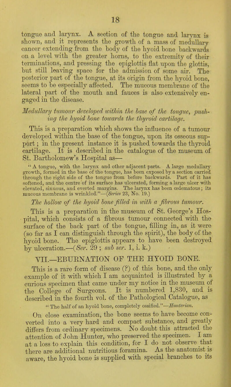 tongiio and larynx. A section of the tongue and larynx is shown, and it represents the growtli of a mass of medullary cancer extending from the body of tlie hyoid bone backwards on a level with the greater horns, to the extremity of their terminations, and pressing the epiglottis flat upon the glottis, but still leaving space for the admission of some air. The posterior part of the tongue, at its origin from the hyoid bone, seems to be especially afi'ected. The mucous membrane of the lateral part of the mouth and fauces is also extensively en- gaged in the disease. Medullary tumour developed within the base of the tongue, push- ing the hyoid hone towards the thyroid cartilage. This is a preparation which shows the influence of a tumour developed within the base of the tongue, upon its osseous sup- port ; in the present instance it is pushed towards the thyroid cartilage. It is described in the catalogue of the museum of St. Bartholomew's Hospital as—  A tongue, with, the larynx and other adjacent parts. A large medullary growth, formed in the base of the tongue, has been exposed by a section carried through the right side of the tong-ue from before backwards. Part of it has softened, and the centre of its surface has ulcerated, forming a large ulcer with elevated, sinuous, and everted margins. The larjoix has been oedematous; its mucous membrane is wrinkled.—{Series 23, No. 19.) The holloio of the hyoid hone filled in with a fibrous tumour. This is a preparation in the museum of St. George's Hos- pital, which consists of a fibrous tumour connected with the surface of the back part of the tongue, filling in, as it were (so far as I can distinguish through the spirit), the body of the hyoid bone. The epiglottis appears to have been destroyed by ulceration.—(>Ser. 29 ; sub ser. 1, i. k.) YII.—EBUENATION OF THE HYOID BONE. This is a rare form of disease (?) of this bone, and the only example of it with which I am acquainted is illustrated by a curious specimen that came under my notice in the museimi of the College of Surgeons. It is numbered 1,830, and is described in the foui-th vol. of the Pathological Catalogue, as  The half of an hyoid bone, completely ossified.—Sunterian. On close examination, the bone seems to have become con- verted into a very hard and compact substance, and greatly diff'ers from ordinary specimens. No doubt this atti-acted the attention of John Hunter, who preserved the specimen. I am at a loss to explain this condition, for I do not observe that there are additional nutritious foramina. As the anatomist is aware, the hyoid bone is supplied with special branches to its