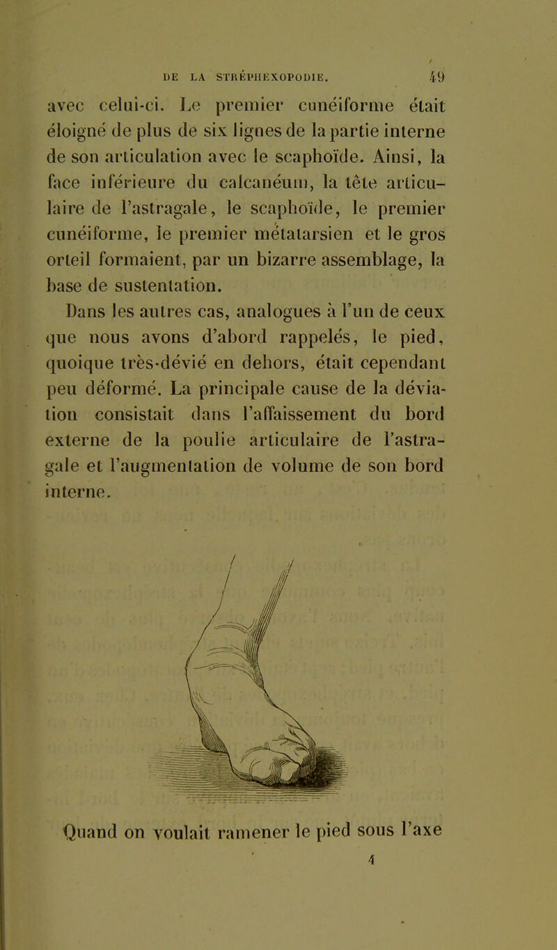 avec celui-ci. Le premier cunéiforme était éloigné de plus de six lignes de la partie interne de son articulation avec le scaphoïde. Ainsi, la li)ce inférieure du calcanéum, la tête articu- laire de l'astragale, le scaphoïde, le premier cunéiforme, le premier métatarsien et le gros orteil formaient, par un bizarre assemblage, la base de sustentation. Dans les autres cas, analogues à l'un de ceux que nous avons d'abord rappelés, le pied, quoique Irès-dévié en dehors, était cependant peu déformé. La principale cause de la dévia- tion consistait dans l'affaissement du bord externe de la poulie articulaire de l'astra- gale et l'augmentation de volume de son bord interne. Quand on voulait ramener le pied sous l'axe 4