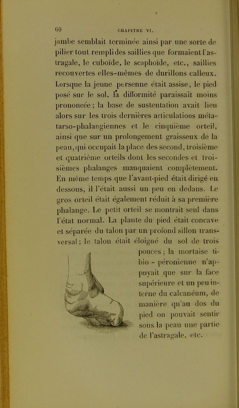 jambe semblait lerminée ainsi par une sorle de pilier tout rempli des saillies que formaient l'as- Iragale, le cuboïde, le scaphoïde, etc., saillies recouvertes elles-mêmes de durillons calleux. Lorsque la jeune persenne était assise, le pied posé sur le sol, la difformité paraissait moins prononcée ; la base de sustentation avait lieu alors sur les trois dernières articulations méta- larso-plialangiennes et le cinquième orteil, ainsi que sur un prolongement graisseux de la peau, qui occupait la place des second, troisième et quatrième orteils dont les secondes et ti oi- sièmes phalanges manquaient complètement. En même temps que l'avant-pied était dirigé en dessous, il l'était aussi un peu en dedans. Le gros orteil était également réduit à sa première phalange. Le petit orteil se montrait seul dans l'état normal. La plante du pied était concave et séparée du talon par un profond sillon trans- versal ; le lalou était éloigné du sol de trois pouces ; la mortaise ti- bio - péronienne n'a[)- puyait que sur la face supérieure et un peu in- terne du calcanéum, de manière qu'au dos du pied on pouvait senlii- sous la peau une partie de l'astragale, etc.