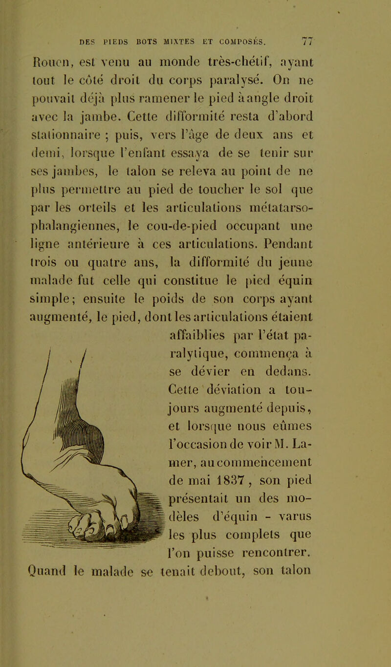 Rouen, est venu au monde très-chétif, ayant tout le côlé droit du corps paralysé. On ne pouvait déjà plus ramener le pied à angle droit avec la jambe. Cette difformité resta d'abord stationnaire ; puis, vers l'âge de deux ans et demi, lorsque l'enfant essaya de se tenir sur ses jambes, le talon se releva au point de ne plus permettre au pied de toucher le sol que par les orteils et les articulations mélatarso- phalangiennes, le cou-de-pied occupant une ligne antérieure à ces articulations. Pendant Irois ou quatre ans, la difformité du jeune malade fut celle qui constitue le pied équin simple; ensuite le poids de son corps ayant augmenté, le pied, dont les articulations étaient Quand le malade se tenait debout, son talon affaiblies par l'état pa- ralytique, commença à se dévier en dedans. Cette déviation a tou- jours augmenté depuis, et lorsfjue nous eûmes l'occasion de voir M. La- mer, aucommeiicement de mai 1837, son pied présentait un des mo- dèles d'équin - varus les plus complets que l'on puisse rencontrer.