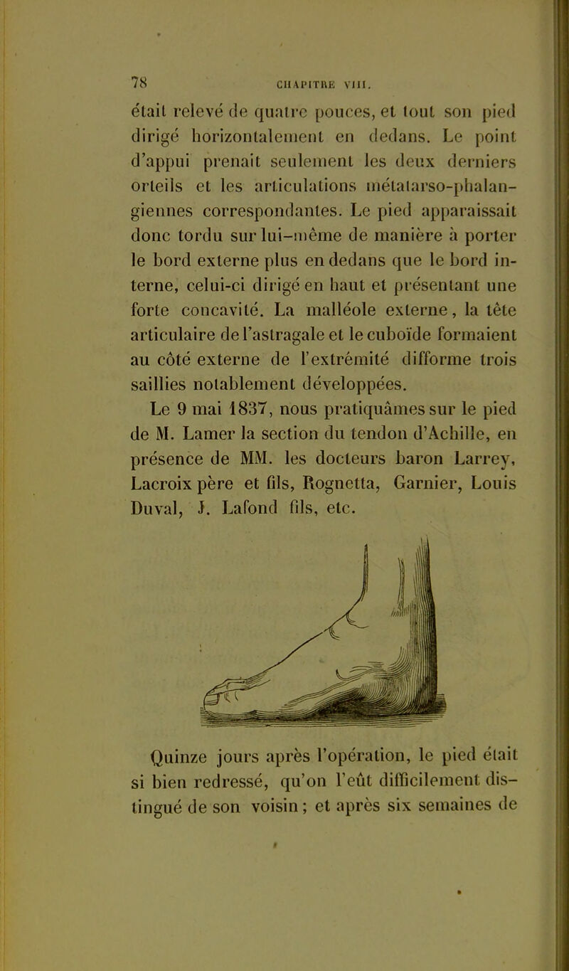était relevé de quatre pouces, et tout son pied dirigé horizontalement en dedans. Le point d'appui prenait seulement les deux derniers orteils et les articulations métalarso-phalan- giennes correspondantes. Le pied apparaissait donc tordu sur lui-même de manière à porter le bord externe plus en dedans que le bord in- terne, celui-ci dirigé en haut et présentant une forte concavité. La malléole externe, la tête articulaire de l'astragale et lecuboïde formaient au côté externe de l'extrémité difforme trois saillies notablement développées. Le 9 mai 1837, nous pratiquâmes sur le pied de M. Lamer la section du tendon d'Achille, en présence de MM. les docteurs baron Larrey, Lacroix père et fils, Rognetta, Garnier, Louis Duval, J. Lafond fils, etc. Quinze jours après l'opération, le pied était si bien redressé, qu'on l'eût difficilement dis- tingué de son voisin ; et après six semaines de