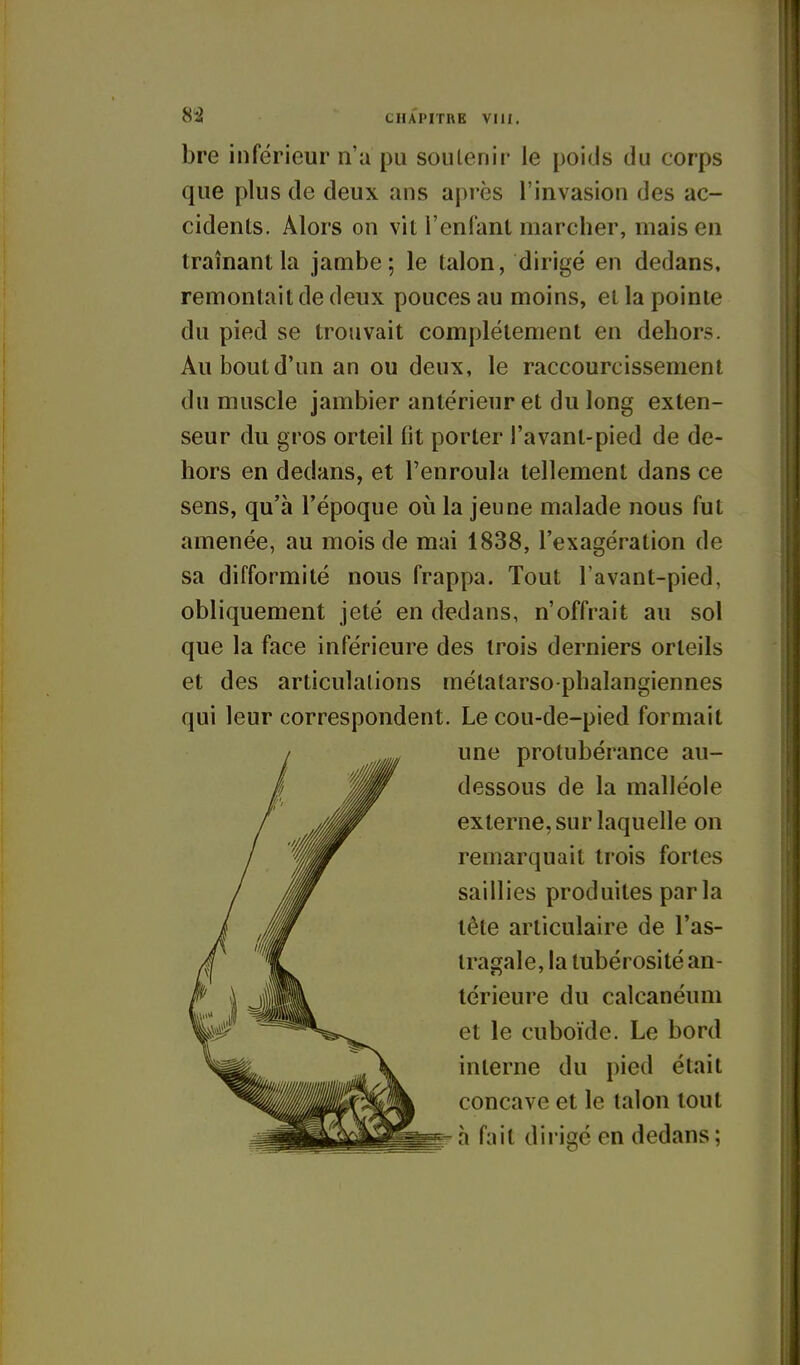bre inférieur n'a pu soutenir le poids du corps que plus de deux ans après l'invasion des ac- cidents. Alors on vit l'entant marcher, maison traînant la jambe; le talon, dirigé en dedans, remontait de deux pouces au moins, et la pointe du pied se trouvait complètement en dehors. Au bout d'un an ou deux, le raccourcissement du muscle jambier antérieur et du long exten- seur du gros orteil lit porter l'avant-pied de de- hors en dedans, et l'enroula tellement dans ce sens, qu'à l'époque où la jeune malade nous fut amenée, au mois de mai 1838, l'exagération de sa difformité nous frappa. Tout l avant-pied, obliquement jeté en dï^dans, n'offrait au sol que la face inférieure des trois derniers orteils et des articulations mélatarso-phalangiennes qui leur correspondent. Le cou-de-pied formait une protubérance au- dessous de la malléole externe, sur laquelle on remarquait trois fortes saillies produites parla tête articulaire de l'as- tragale, la tubérosité an- térieure du calcanéum et le cuboïde. Le bord interne du pied était concave et le talon tout h fait dirigé en dedans;