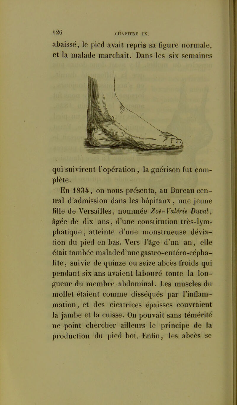 abaissé, le pied avait repris sa figure normale, et la malade marchait. Dans les six semaines qui suivirent F opération , la guérison fut com- plète. En 1834, on nous présenta, au Bureau cen- tral d'admission dans les hôpitaux , une jeune fille de Versailles, nommée Zoé- Valérie Duval, âgée de dix ans, d'une constitution très-lym- phatique , atteinte d'une monstrueuse dévia- lion du pied en bas. Vers l'âge d'un an, elle était tombée malade d'une gasiro-entéro-cépha- lite, suivie de quinze ou seize abcès froids qui pendant six ans avaient labouré toute la lon- gueur du membre abdominal. Les muscles du mollet étaient comme disséqués par l'inflam- mation, et des cicatrices épaisses couvraient la jambe et la cuisse. On pouvait sans témérité ne point chercher ailleurs le principe de la production du pied bol. Enlîn, les abcès se