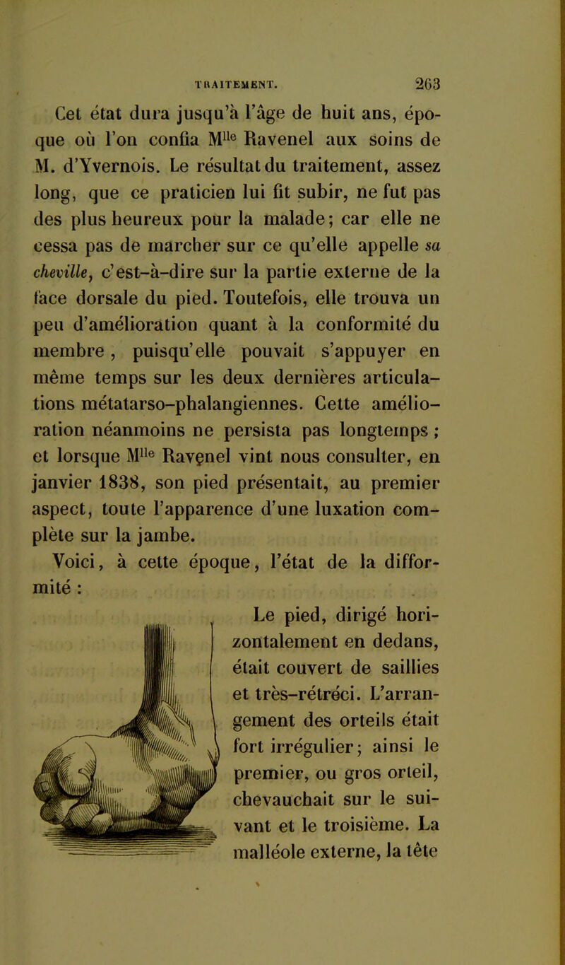 Cet état dura jusqu'à l'âge de huit ans, épo- que où l'on confia M*^^ Ravenel aux soins de M. d'Yvernois. Le résultat du traitement, assez long, que ce praticien lui fit subir, ne fut pas des plus heureux pour la malade ; car elle ne cessa pas de marcher sur ce qu'elle appelle sa chevillcy c'est-à-dire sur la partie externe de la face dorsale du pied. Toutefois, elle trouva un peu d'amélioration quant à la conformité du membre, puisqu'elle pouvait s'appuyer en même temps sur les deux dernières articula- tions métatarso-phalangiennes. Cette amélio- ration néanmoins ne persista pas longtemps ; et lorsque M^^^ Ravçnel vint nous consulter, en janvier 1838, son pied présentait, au premier aspect, toute l'apparence d'une luxation com- plète sur la jambe. Voici, à cette époque, l'état de la diffor- mité : Le pied, dirigé hori- zontalement en dedans, était couvert de saillies et très-rétréci. L'arran- gement des orteils était fort irrégulier; ainsi le premier, ou gros orteil, chevauchait sur le sui- vant et le troisième. La malléole externe, la tête