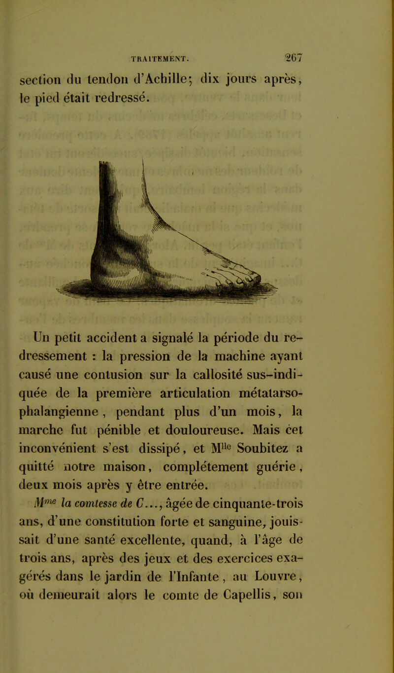 section du tendon d'Achille-, dix jours après, le pied était redressé. Un petit accident a signalé la période du re- dressement : la pression de la machine ayant causé une contusion sur la callosité sus-indi- quée de la première articulation métalarso- phalangienne , pendant plus d'un mois, la marche fut pénible et douloureuse. Mais cet inconvénient s'est dissipé, et M^^^ Soubitez a quitté notre maison, complètement guérie, deux mois après y être entrée. M^ la comtesse de (7..., âgée de cinquante-trois ans, d'une constitution forte et sanguine, jouis- sait d'une santé excellente, quand, à l'âge de trois ans, après des jeux et des exercices exa- gérés dans le jardin de l'Infante , au Louvre, où demeurait alors le comte de Capellis, son