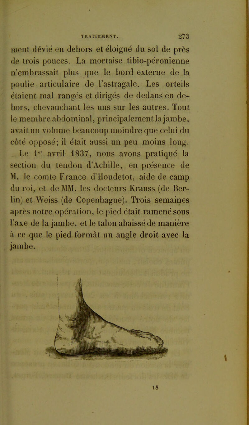 nient dévié en dehors et éloigné du sol de près de trois pouces. La mortaise tibio-péronienne n'embrassait plus que le bord externe de la poulie articulaire de l'astragale. Les orteils étaient mal rangés et dirigés de dedans en de- hors, chevauchant les uns sur les autres. Tout le membre abdominal, principalement la jambe, avait un volume beaucoup moindre que celui du côté opposé; il était aussi un peu moins long. Le 1' avril 1837, nous avons pratiqué la section du tendon d'Achille, en présence de M. le comte France d'Houdetot, aide de camp du roi, et de MM. les docteurs Krauss (de Ber- lin) et Weiss (de Copenhague). Trois semaines après notre opération, le pied était ramené sous l'axe de la jambe, et le talon abaissé de manière à ce que le pied formât un angle droit avec la jambe. 18