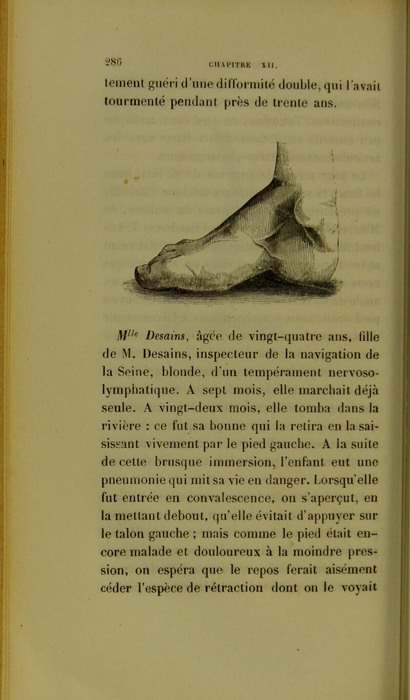 ^80 CIIAJ'ITRIÎ XII. teinent guéi-i d'une diiïoniiilé double, qui l'avait tourmenté pendant près de trente ans. M^'^ Desains, âgée de vingt-quatre ans, fille de M. Desains, inspecteur de la navigation de la Seine, blonde, d'un tempérament nervoso- lymphatique. A sept mois, elle marchait déjà seule. A vingt-deux mois, elle tomba dans la rivière : ce fut sa bonne qui la relira en la sai- sissant vivement par le pied gauche. A la suite de cette brusque immersion, l'enfant eut une pneumonie qui mit sa vie en danger. Lorsqu'elle fut entrée en convalescence, on s'aperçut, en la mettant debout, qu'elle évitait d'appuyer sur le talon gauche ; mais comme le pied était en- core malade et douloureux à la moindre pres- sion, on espéra que le repos ferait aisément céder l'espèce de rétraction dont on le voyait