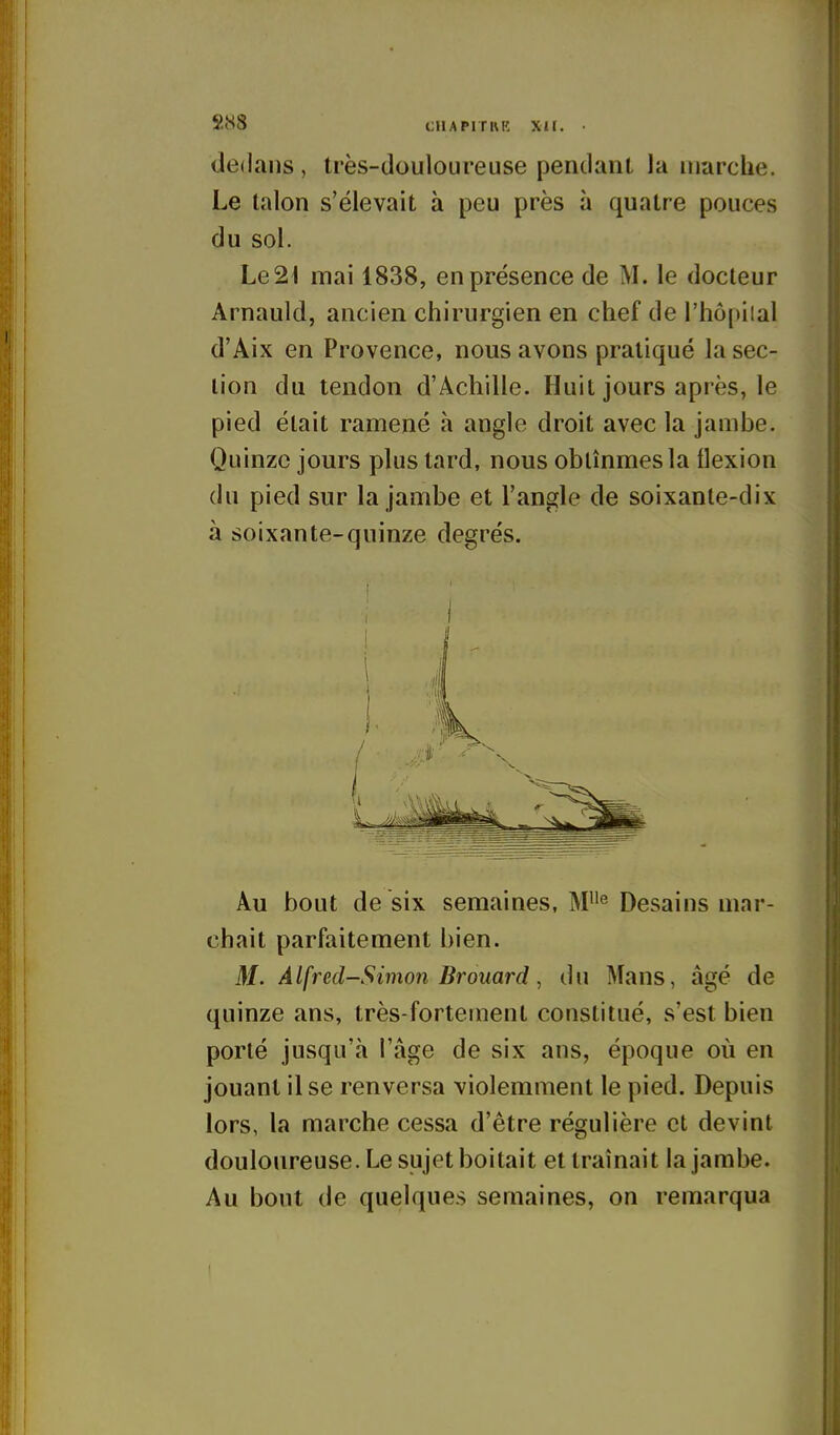 SH8 CHAPITKIC XII. • dedans, très-douloureuse pendant la marche. Le talon s'élevait à peu près à quatre pouces du sol. Le2t mai 1838, en présence de M. le docteur Arnauld, ancien chirurgien en chef de rhô()i!al d'Aix en Provence, nous avons pratiqué la sec- lion du tendon d'Achille. Huit jours après, le pied était ramené à angle droit avec la jambe. Quinze jours plus tard, nous obtînmes la flexion du pied sur la jambe et l'angle de soixante-dix à soixante-quinze degrés. Au bout de six semaines, M^ Desains mar- chait parfaitement bien. M. Alfred-Simon Brouard, du Mans, âgé de quinze ans, très-fortement constitué, s'est bien porté jusqu'à l'âge de six ans, époque où en jouant il se renversa violemment le pied. Depuis lors, la marche cessa d'être régulière et devint douloureuse. Le sujet boitait et traînait la jambe. Au bout de quelques semaines, on remarqua