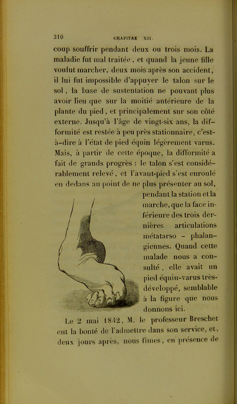 coup souffrir pendant deux ou trois mois. La maladie fut mal traitée, et quand la jeune fille voulut marcher, deux mois après son accident, il lui fut impossible d'appuyer le talon sur le sol , la base de sustentation ne pouvant plus avoir lieu que sur la moitié antérieure de la plante du pied, et principalement sur son côté externe. Jusqu'à l'âge de vingt-six ans, la dif- formité est restée à peu près stationnaire, c'est- à-dire à l'état de pied équin légèrement varus. Mais, à partir de celte époque, la difformité a fait de grands progrès : le talon s'est considé- rablement relevé, et l'avant-pied s'est enroulé en dedans au point de ne plus présenter au sol, pendant la station et la marche, que la face in- férieure des trois der- nières articulations métatarso - phalan- giennes. Quand cette malade nous a con- sulté , elle avait un pied équin-varustrès- développé, semblable à la figure que nous donnons ici. Le 2 mai 1842, M. le professeur Breschet eut la bonté de l'admettre dans son service, et, deux jours après, nous fîmes, en présence de