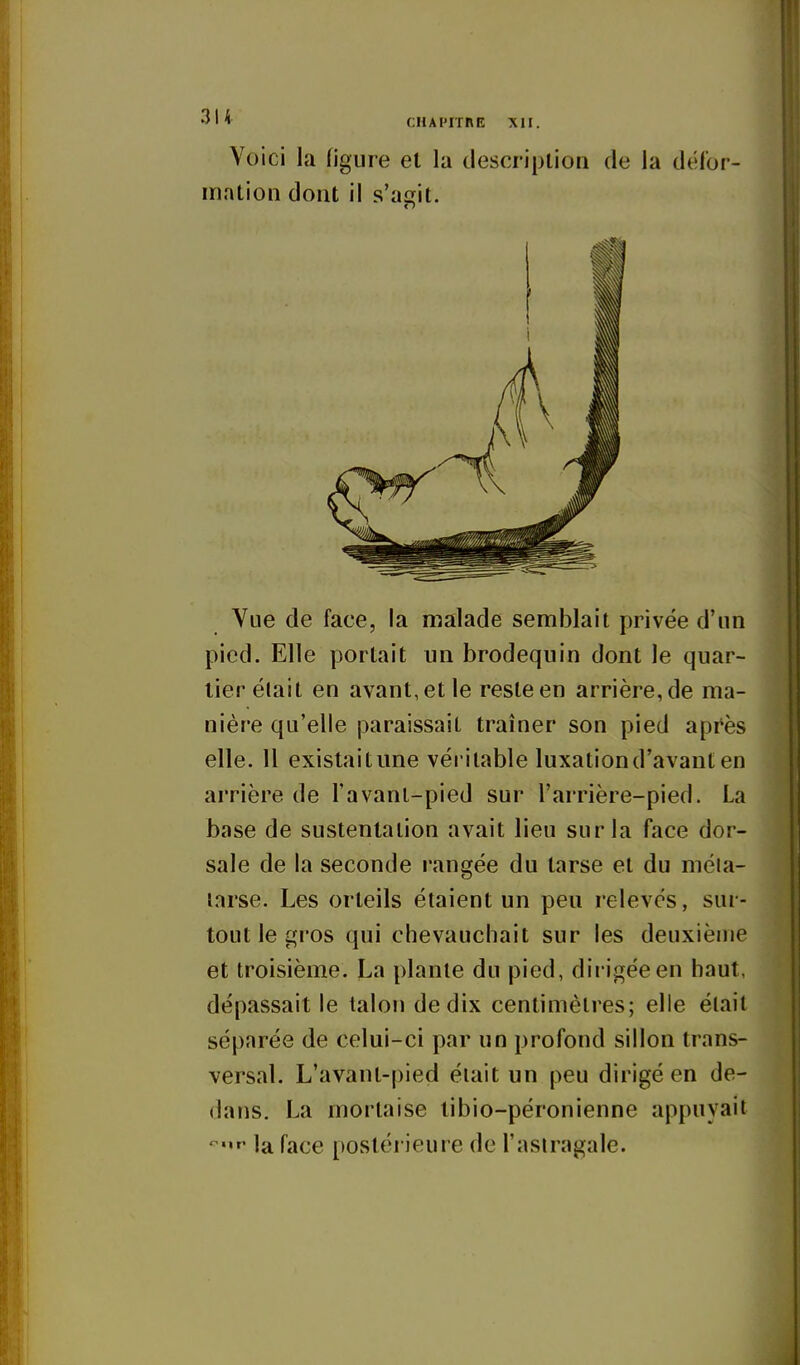 I < cHAi'irnE XII. Voici la figure et la description de la délor- inntion dont il s'acfit. Vue de face, la malade semblait privée d'un pied. Elle portait un brodequin dont le quar- tier élait en avant, et le reste en arrière, de ma- nière qu'elle paraissait traîner son pied après elle. Il existai tune véritable luxation d'avant en arrière de l'avanl-pied sur l'arrière-pied. La base de sustentation avait lieu sur la face dor- sale de la seconde rangée du tarse et du méia- larse. Les orteils étaient un peu relevés, sur- tout le gros qui chevauchait sur les deuxième et troisième. La plante du pied, dirigée en haut, dépassait le talon de dix centimètres; elle était séparée de celui-ci par un profond sillon trans- versal. L'avant-pied élait un peu dirigé en de- dans. La mortaise tibio-péronienne appuyait '^'^»' la face postérieure de l'astragale.