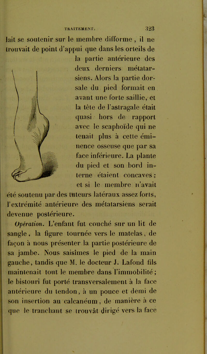 lait se soutenir sur le membre difforme , il ne trouvait de point d'appui que dans les orteils de été soutenu par des tuteurs latéraux assez foris, l'extrémité antérieure des métatarsiens serait devenue postérieure. Opération. L'enfant fut couché sur un lit de sangle, la figure tournée vers le matelas, de façon h nous présenter la partie postérieure de sa jambe. Nous saisîmes le pied de la main gauche, tandis que M. le docteur J. Lafond fils maintenait tout le membre dans l'immobilité ; le bistouri fut porté transversalement à la face antérieure du tendon, h un pouce et demi de son insertion au calcanéum, de manière h ce que le tranchant se trouvât dirigé vers la face la pai'tie antérieure des deux derniers métatar- siens. Alors la partie dor- sale du pied formait en avant une forte saillie, et la tête de l'astragale était quasi hors de rapport avec le scaphoïde qui ne tenait plus à cette émi- nence osseuse que par sa face inférieure. La plante du pied et son bord in- terne étaient concaves ; et si le membre n'avait