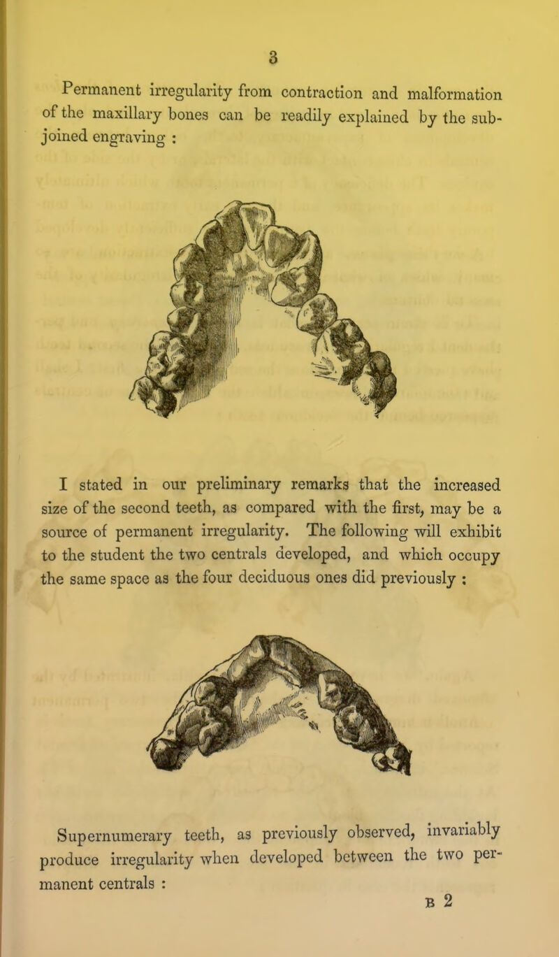 Permanent irregularity from contraction and malformation of the maxillary bones can be readily explained by the sub- joined engraving : I stated in our preliminary remarks that the increased size of the second teeth, as compared with the first, may be a source of permanent irregularity. The following will exhibit to the student the two centrals developed, and which occupy the same space as the four deciduous ones did previously : Supernumerary teeth, as previously observed, invariably produce irregularity when developed between the two per- manent centrals :