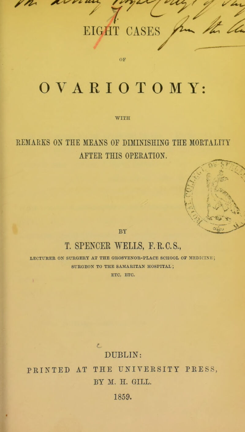 EIGHT CASES OF OVARIOTOMY; WITH REMARKS ON THE MEANS OF DIMINISHING THE MORTALITY AFTER THIS OPERATION. BY T. SPENCER WELLS, F.E.C.S., LECTUREB ON SURGERY AT THE OROSVENOR-PLACE SCHOOL OF MEDICIXK J SURGEON TO THE SAMARITAN HOSPITAL ; ETC. ETC. DUBLIN: PRINTED AT THE UNIVERSITY PRESS, BY M. H. GILL. 1859.