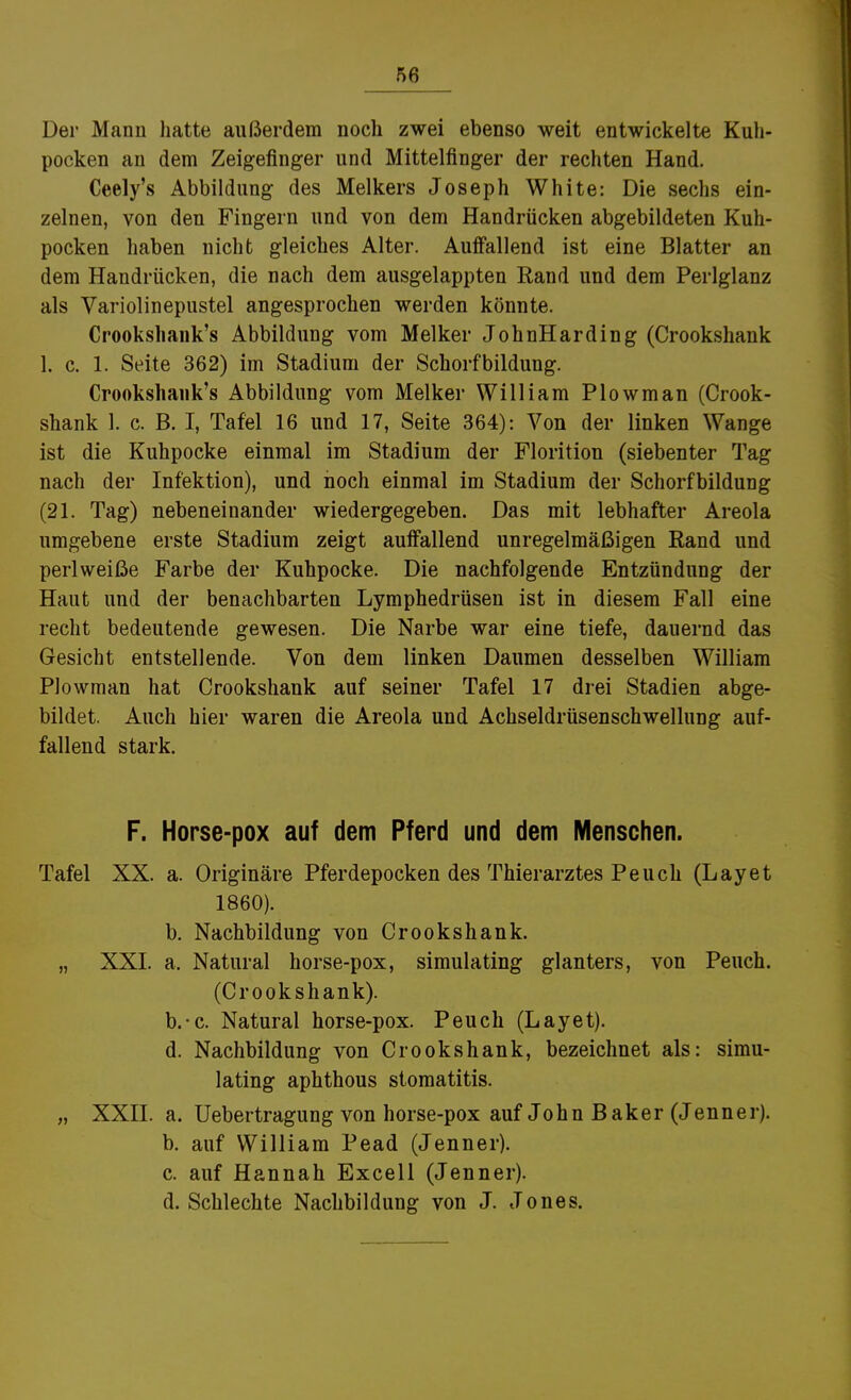 Der Mann hatte außerdem noch zwei ebenso weit entwickelte Kuh- pocken an dem Zeigefinger und Mittelfinger der rechten Hand. Ceely's Abbildung des Melkers Joseph White: Die sechs ein- zelnen, von den Fingern und von dem Handrücken abgebildeten Kuh- pocken haben nicht gleiches Alter. Auffallend ist eine Blatter an dem Handrücken, die nach dem ausgelappten Rand und dem Perlglanz als Variolinepustel angesprochen werden könnte. Crookshank's Abbildung vom Melker JohnHarding (Crookshank 1. c. 1. Seite 362) im Stadium der Schorfbildung. Crookshank's Abbildung vom Melker William Plowman (Crook- shank 1. c. B. I, Tafel 16 und 17, Seite 364): Von der linken Wange ist die Kuhpocke einmal im Stadium der Florition (siebenter Tag nach der Infektion), und noch einmal im Stadium der Schorfbildung (21. Tag) nebeneinander wiedergegeben. Das mit lebhafter Areola umgebene erste Stadium zeigt auffallend unregelmäßigen Rand und perl weiße Farbe der Kuhpocke. Die nachfolgende Entzündung der Haut und der benachbarten Lymphedrüsen ist in diesem Fall eine recht bedeutende gewesen. Die Narbe war eine tiefe, dauernd das Gesicht entstellende. Von dem linken Daumen desselben William Plowman hat Crookshank auf seiner Tafel 17 drei Stadien abge- bildet. Auch hier waren die Areola und Achseldrüsenschwellung auf- fallend stark. F. Horse-pox auf dem Pferd und dem Menschen. Tafel XX. a. Originäre Pferdepocken des Thierarztes Peuch (Layet 1860). b. Nachbildung von Crookshank. „ XXI. a. Natural horse-pox, simulating glanters, von Peuch. (Crookshank). b.-c. Natural horse-pox. Peuch (Layet). d. Nachbildung von Crookshank, bezeichnet als: simu- lating aphthous Stomatitis. „ XXII. a. Uebertragung von horse-pox auf John Baker (Jenner). b. auf William Pead (Jenner). c. auf Hannah Excell (Jenner). d. Schlechte Nachbildung von J. Jones.