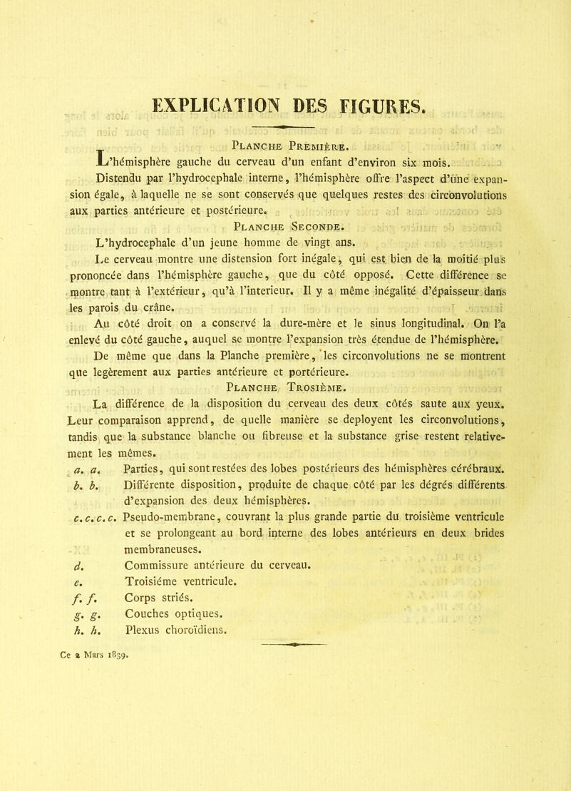 ■i : C. : EXPLICATION DES FIGURES Planche Première. JL’hémisphère gauche du cerveau d’un enfant d’environ six mois. Distendu par l’hydrocephale interne, l’hémisphère oifre l’aspect d’une expan- sion égale, à laquelle ne se sont conservés que quelques restes des circonvolutions aux parties antérieure et postérieure. Planche Seconde. L’hydrocephale d’un jeune homme de vingt ans. Le cerveau montre une distension fort inégale, qui est bien de la moitié plus prononcée dans l’hémisphère gauche, que du côté opposé. Cette différence se montre tant à l’extérieur, qu’à l’interieur. Il y a même inégalité d’épaisseur dans les parois du crâne. Au côté droit on a conservé la dure-mère et le sinus longitudinal. On l’a De même que dans la Planche première, les circonvolutions ne se montrent que légèrement aux parties antérieure et portérieure. La différence de la disposition du cerveau des deux côtés saute aux yeux. Leur comparaison apprend, de quelle manière se deployent les circonvolutions, tandis que la substance blanche ou fibreuse et la substance grise restent relative- ment les mêmes. a. a. Parties, qui sont restées des lobes postérieurs des hémisphères cérébraux. b. b. Différente disposition, produite de chaque côté par les dégrés différents c.c.c.c. Pseudo-membrane, couvrant la plus grande partie du troisième ventricule enlevé du côté gauche, auquel se montre l’expansion très étendue de l’hémisphère. Planche Trosième. d’expansion des deux hémisphères. /./• e. et se prolongeant au bord interne des lobes antérieurs en deux brides membraneuses. Commissure antérieure du cerveau. Troisième ventricule. Corps striés. Couches optiques. Plexus choroïdiens. Ce z Mars 1839.