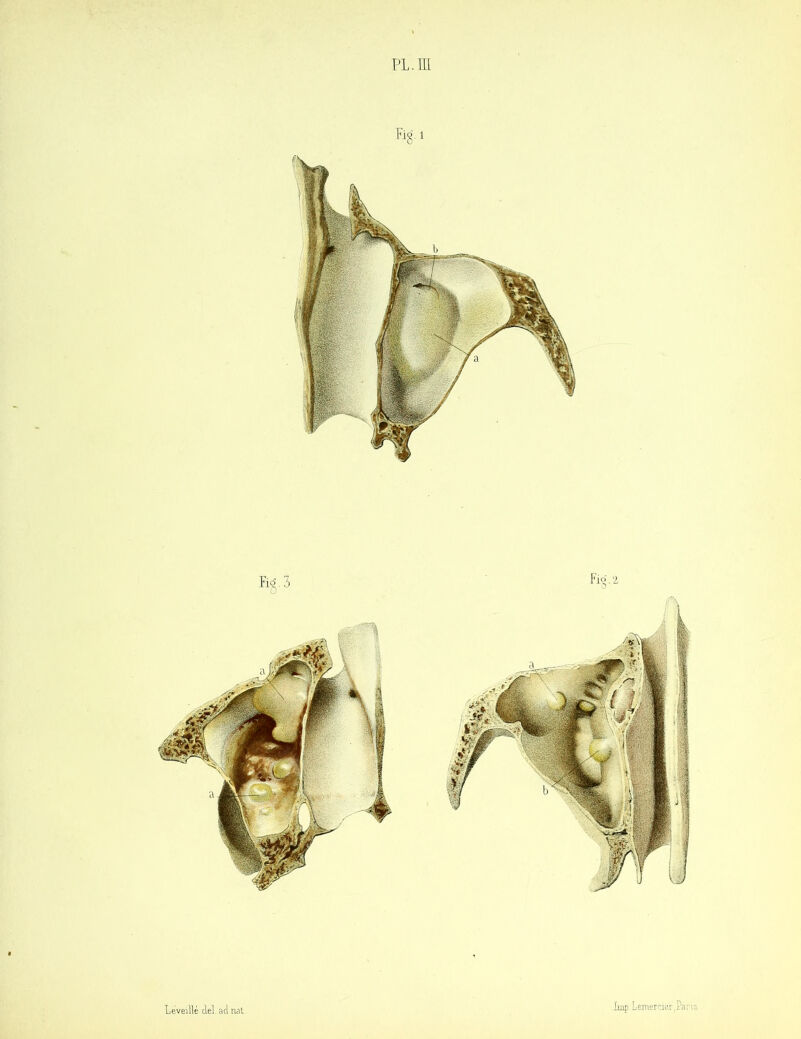 Léveillé ciel, acl nat dmpiemerçier.Pari: