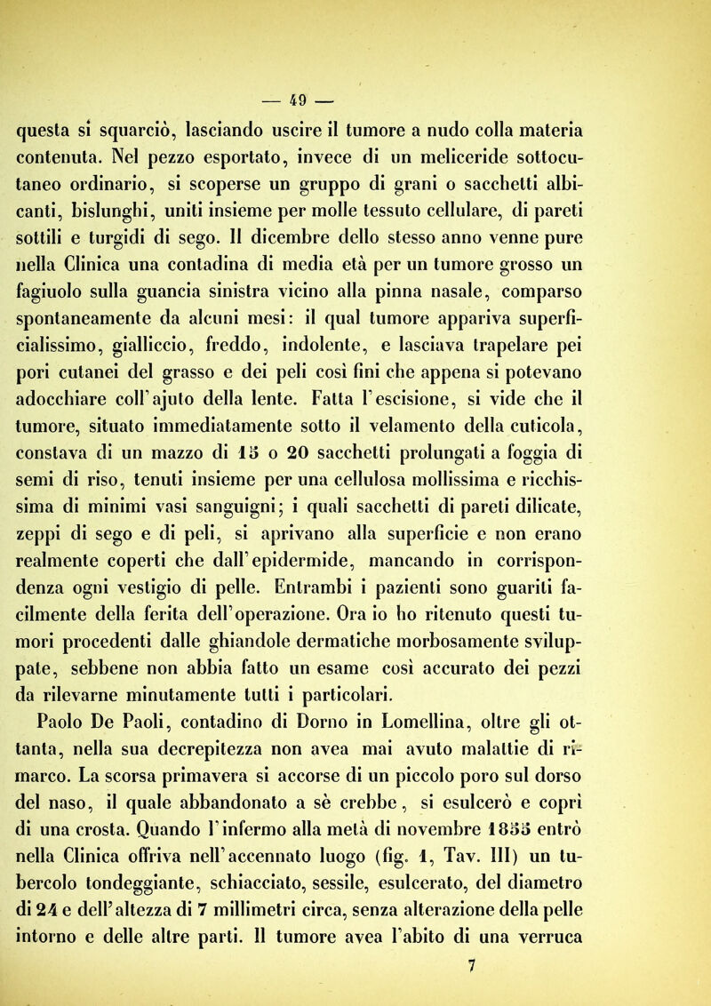 questa si squarciò, lasciando uscire il tumore a nudo colla materia contenuta. Nel pezzo esportato, invece di un meliceride sottocu- taneo ordinario, si scoperse un gruppo di grani o sacchetti albi- canti, bislunghi, uniti insieme per molle tessuto cellulare, di pareti sottili e turgidi di sego. II dicembre dello stesso anno venne pure nella Clinica una contadina di media età per un tumore grosso un fagiuolo sulla guancia sinistra vicino alla pinna nasale, comparso spontaneamente da alcuni mesi: il qual tumore appariva superfi- cialissimo, gialliccio, freddo, indolente, e lasciava trapelare pei pori cutanei del grasso e dei peli così fini che appena si potevano adocchiare coll ajuto della lente. Fatta l escisione, si vide che il tumore, situato immediatamente sotto il velamento della cuticola, constava di un mazzo di 15 o 20 sacchetti prolungati a foggia di semi di riso, tenuti insieme per una cellulosa mollissima e ricchis- sima di minimi vasi sanguigni; i quali sacchetti di pareti dilicate, zeppi di sego e di peli, si aprivano alla superficie e non erano realmente coperti che dall’ epidermide, mancando in corrispon- denza ogni vestigio di pelle. Entrambi i pazienti sono guariti fa- cilmente della ferita dell’operazione. Ora io ho ritenuto questi tu- mori procedenti dalle ghiandole dermatiche morbosamente svilup- pate, sebbene non abbia fatto un esame così accurato dei pezzi da rilevarne minutamente tutti i particolari. Paolo De Paoli, contadino di Domo in Lomellina, oltre gli ot- tanta, nella sua decrepitezza non avea mai avuto malattie di ri- marco. La scorsa primavera si accorse di un piccolo poro sul dorso del naso, il quale abbandonato a sè crebbe, si esulcerò e coprì di una crosta. Quando F infermo alla metà di novembre 1855 entrò nella Clinica offriva nell’accennato luogo (fig. 1, Tav. Ili) un tu- bercolo tondeggiante, schiacciato, sessile, esulcerato, del diametro di 24 e delF altezza di 7 millimetri circa, senza alterazione della pelle intorno e delle altre parti. 11 tumore avea l abito di una verruca 7
