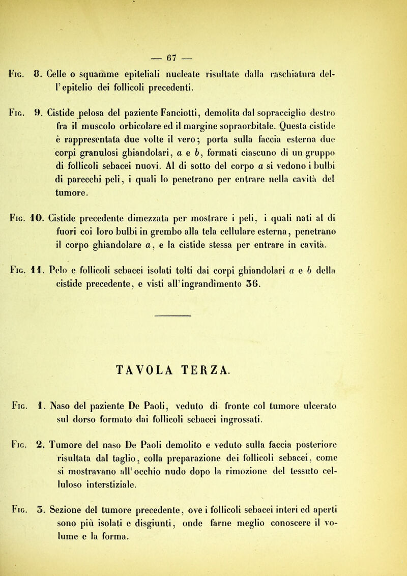 — 07 — Fig. 8. Celle o squamme epiteliali nucleate risultate dalla raschiatura del- l’epitelio dei follicoli precedenti. Fig. 9. Cistide pelosa del paziente Fanciotti, demolita dal sopracciglio destro fra il muscolo orbicolare ed il margine sopraorbitale. Questa cistide è rappresentata due volte il vero ; porta sulla faccia esterna due corpi granulosi ghiandolari, a e 6, formati ciascuno di un gruppo di follicoli sebacei nuovi. Al di sotto del corpo a si vedono i bulbi di parecchi peli, i quali lo penetrano per entrare nella cavità del tumore. Fig. iO. Cistide precedente dimezzata per mostrare i peli, i quali nati al di fuori coi loro bulbi in grembo alla tela cellulare esterna, penetrano il corpo ghiandolare a, e la cistide stessa per entrare in cavità. Fig. 11. Pelo e follicoli sebacei isolati tolti dai corpi ghiandolari a e b della cistide precedente, e visti all’ingrandimento 56. TAVOLA TERZA. Fig. 1. Naso del paziente De Paoli, veduto di fronte col tumore ulcerato sul dorso formato dai follicoli sebacei ingrossati. Fig. 2. Tumore del naso De Paoli demolito e veduto sulla faccia posteriore risultata dal taglio, colla preparazione dei follicoli sebacei, come si mostravano all’occhio nudo dopo la rimozione del tessuto cel- luloso interstiziale. Fig. 3. Sezione del tumore precedente, ove i follicoli sebacei interi ed aperti sono più isolati e disgiunti, onde farne meglio conoscere il vo- lume e la forma.