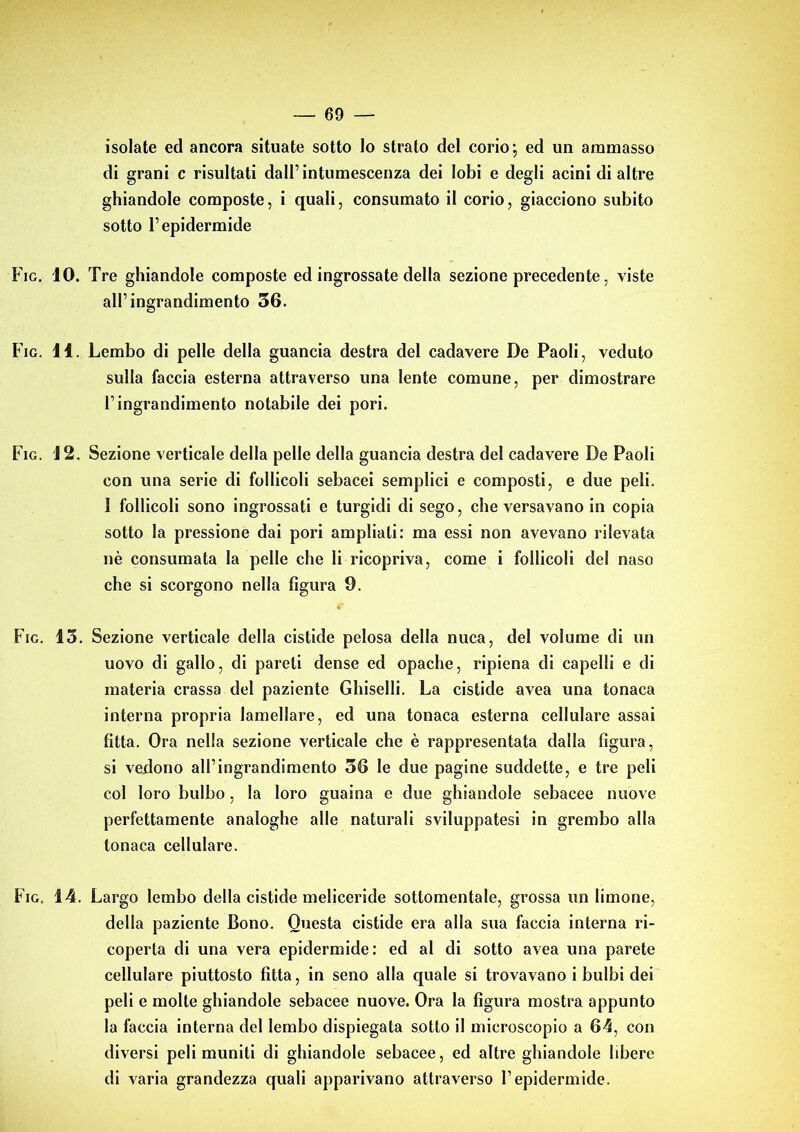 isolate ed ancora situate sotto lo strato del corio; ed un ammasso di grani c risultati dall’intumescenza dei lobi e degli acini di altre ghiandole composte, i quali, consumato il corio, giacciono subito sotto l’epidermide Fio. IO. Tre ghiandole composte ed ingrossate della sezione precedente, viste all’ingrandimento 36. Fio. 11. Lembo di pelle della guancia destra del cadavere De Paoli, veduto sulla faccia esterna attraverso una lente comune, per dimostrare l’ingrandimento notabile dei pori. Fio. 12. Sezione verticale della pelle della guancia destra del cadavere De Paoli con una serie di follicoli sebacei semplici e composti, e due peli. 1 follicoli sono ingrossati e turgidi di sego, che versavano in copia sotto la pressione dai pori ampliali: ma essi non avevano rilevata nè consumata la pelle che li ricopriva, come i follicoli del naso che si scorgono nella figura 9. Fio. 13. Sezione verticale della cistide pelosa della nuca, del volume di un uovo di gallo, di pareti dense ed opache, ripiena di capelli e di materia crassa del paziente Ghiselli. La cistide ovea una tonaca interna propria lamellare, ed una tonaca esterna cellulare assai fitta. Ora nella sezione verticale che è rappresentata dalla figura, si vedono all’ingrandimento 36 le due pagine suddette, e tre peli col loro bulbo, la loro guaina e due ghiandole sebacee nuove perfettamente analoghe alle naturali sviluppatesi in grembo alla tonaca cellulare. Fig. 14. Largo lembo della cistide meliceride sottomentale, grossa un limone, della paziente Bono. Questa cistide era alla sua faccia interna ri- coperta di una vera epidermide: ed al di sotto avea una parete cellulare piuttosto fitta, in seno alla quale si trovavano i bulbi dei peli e molte ghiandole sebacee nuove. Ora la figura mostra appunto la faccia interna del lembo dispiegata sotto il microscopio a 64, con diversi peli muniti di ghiandole sebacee, ed altre ghiandole libere di varia grandezza quali apparivano attraverso l’epidermide.