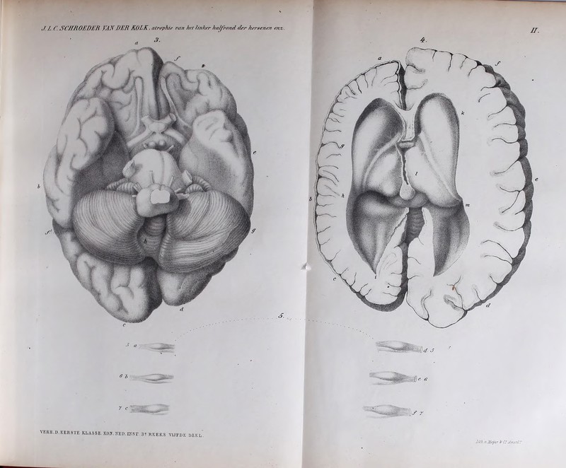 ,/ ƒ (\ SC/1'HOKDER VAN DER KOLK. alrop/Ue van het linker halfrond drr hersenen «vz.tr. 3. b S. VERll.n. EER8TB KLASSE. KOIT. KEU. HTST. 3? REEKS VIJFDE DEEL