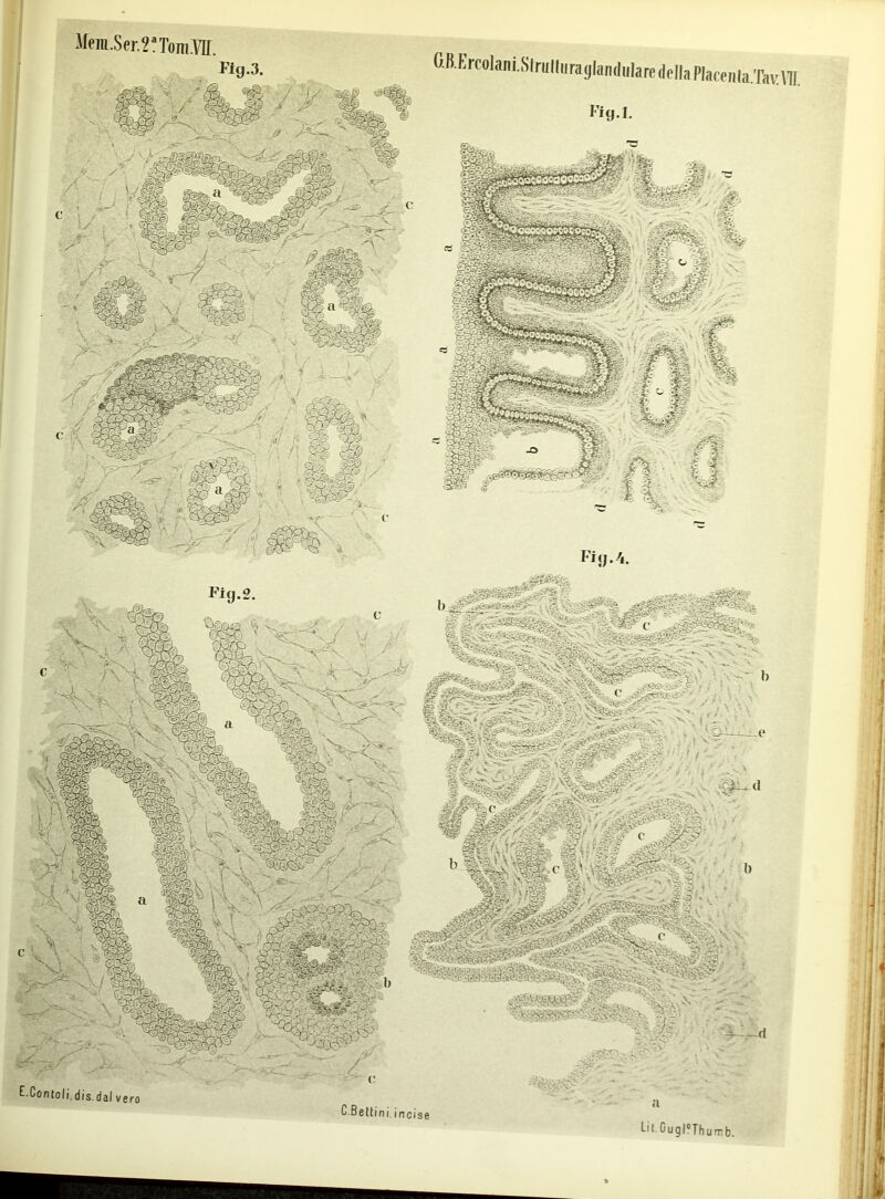 Jfem.Ser.2fTomro. OB.Eroolani.Slriilliiraglandulare (If lla Plate,iia
