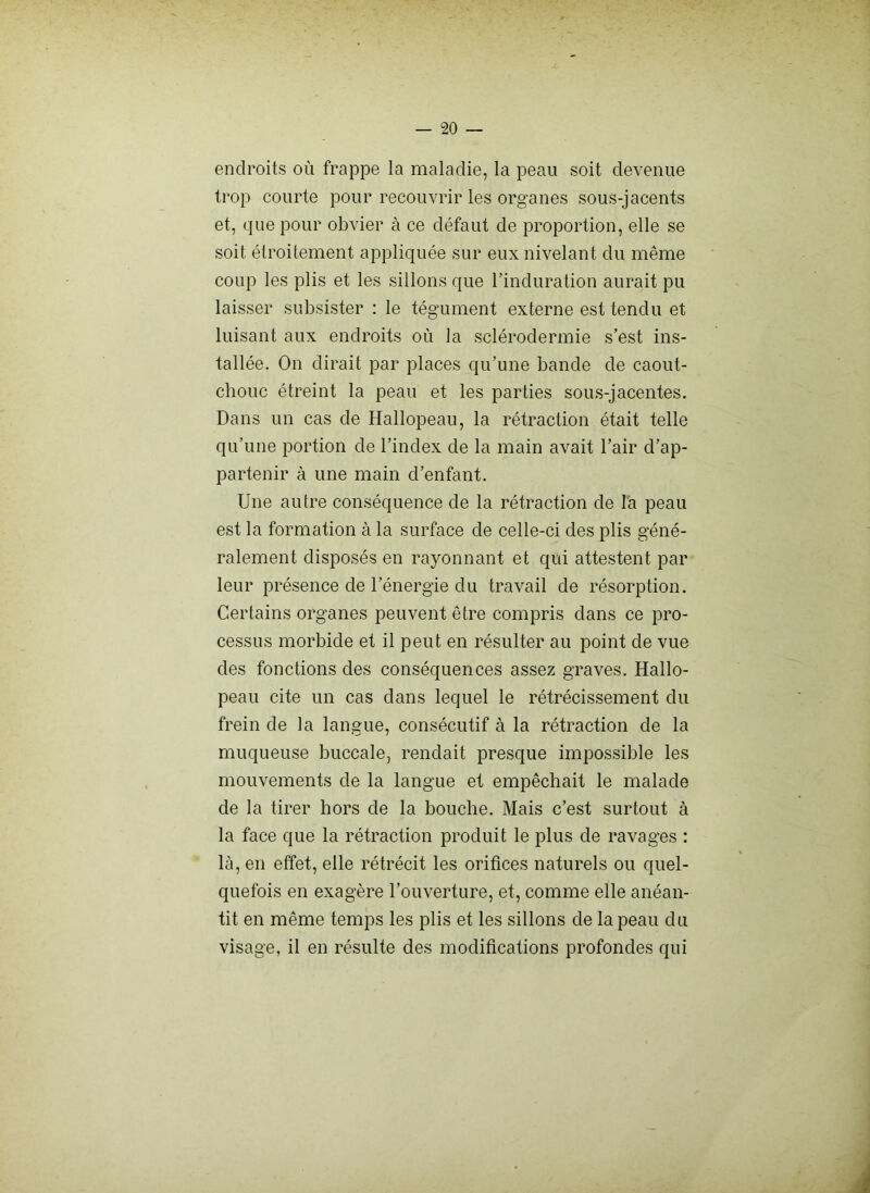 endroits où frappe la maladie, la peau soit devenue trop courte pour recouvrir les organes sous-jacents et, que pour obvier à ce défaut de proportion, elle se soit étroitement appliquée sur eux nivelant du même coup les plis et les sillons que Tinduration aurait pu laisser subsister : le tégument externe est tendu et luisant aux endroits où la sclérodermie s’est ins- tallée. On dirait par places qu’une bande de caout- chouc étreint la peau et les parties sous-jacentes. Dans un cas de Hallopeau, la rétraction était telle qu’une portion de l’index de la main avait l’air d’ap- partenir à une main d’enfant. Une autre conséquence de la rétraction de là peau est la formation à la surface de celle-ci des plis géné- ralement disposés en rayonnant et qui attestent par leur présence de l’énergie du travail de résorption. Certains organes peuvent être compris dans ce pro- cessus morbide et il peut en résulter au point de vue des fonctions des conséquences assez graves. Hallo- peau cite un cas dans lequel le rétrécissement du frein de la langue, consécutif à la rétraction de la muqueuse buccale, rendait presque impossible les mouvements de la langue et empêchait le malade de la tirer hors de la bouche. Mais c’est surtout à la face que la rétraction produit le plus de ravages : là, en effet, elle rétrécit les orifices naturels ou quel- quefois en exagère l’ouverture, et, comme elle anéan- tit en même temps les plis et les sillons de la peau du visage, il en résulte des modifications profondes qui