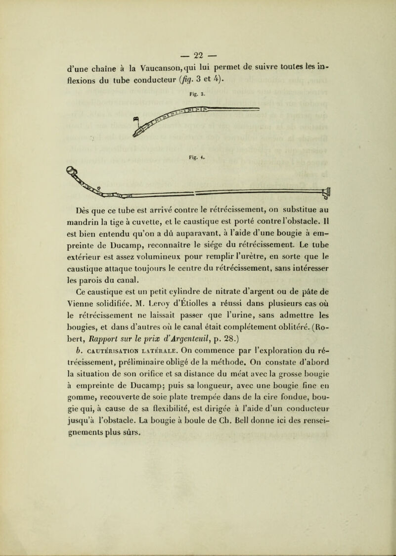 d’une chaîne à la Vaucanson,qui lui permet de suivre toutes les in flexions du tube conducteur {fig. 3 et 4). Fig. 3. . I t| Dès que ce tube est arrivé contre le rétrécissement, on substitue au mandrin la tige à cuvette, et le caustique est porté contre l’obstacle. Il est bien entendu qu’on a dû auparavant, à l’aide d’une bougie à em- preinte de Ducamp, reconnaître le siège du rétrécissement. Le tube extérieur est assez volumineux pour remplii l’urètre, en sorte que le caustique attaque toujours le centre du rétrécissement, sans intéresser les parois du canal. Ce caustique est un petit cylindre de nitrate d’argent ou de pâte de Vienne solidifiée. M. I.eroy d’EtioIles a réussi dans plusieurs cas où le rétrécissement ne laissait passer que l’urine, sans admettre les bougies, et dans d’autres où le canal était complètement oblitéré. (Ro- bert, Rapport sur le prix d’Ârgenteuil, p. 28.) b. CAUTÉRISATION LATÉRALE. On commence par l’exploration du ré- trécissement, préliminaire obligé de la méthode. On constate d’abord la situation de son orifice et sa distance du méat avec la grosse bougie à empreinte de Ducamp; puis sa longueur, avec une bougie fine en gomme, recouverte de soie plate trempée dans de la cire fondue, bou- gie qui, à cause de sa flexibilité, est dirigée à l’aide d’un conducteur jusqu’à l’obstacle. La bougie à boule de Ch. Bell donne ici des rensei- gnements plus sûrs.