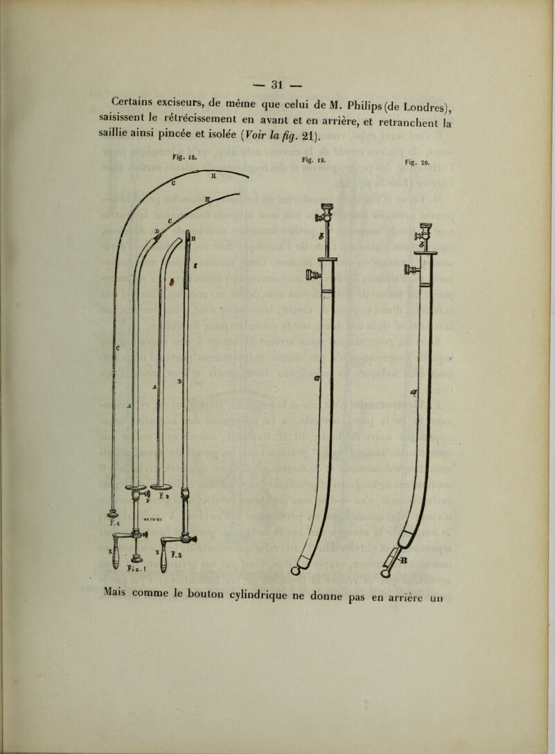 que celui de M. Philips (de Londres), en avant et en arrière, et retranchent la [Voir la fig. 21). Certains exciseurs, de même saisissent le rétrécissement saillie ainsi pincée et isolée Fig. 18. Fig. 19. pjg_ 20. Mais comme le bouton cylindrique ne donne pas en arrière un